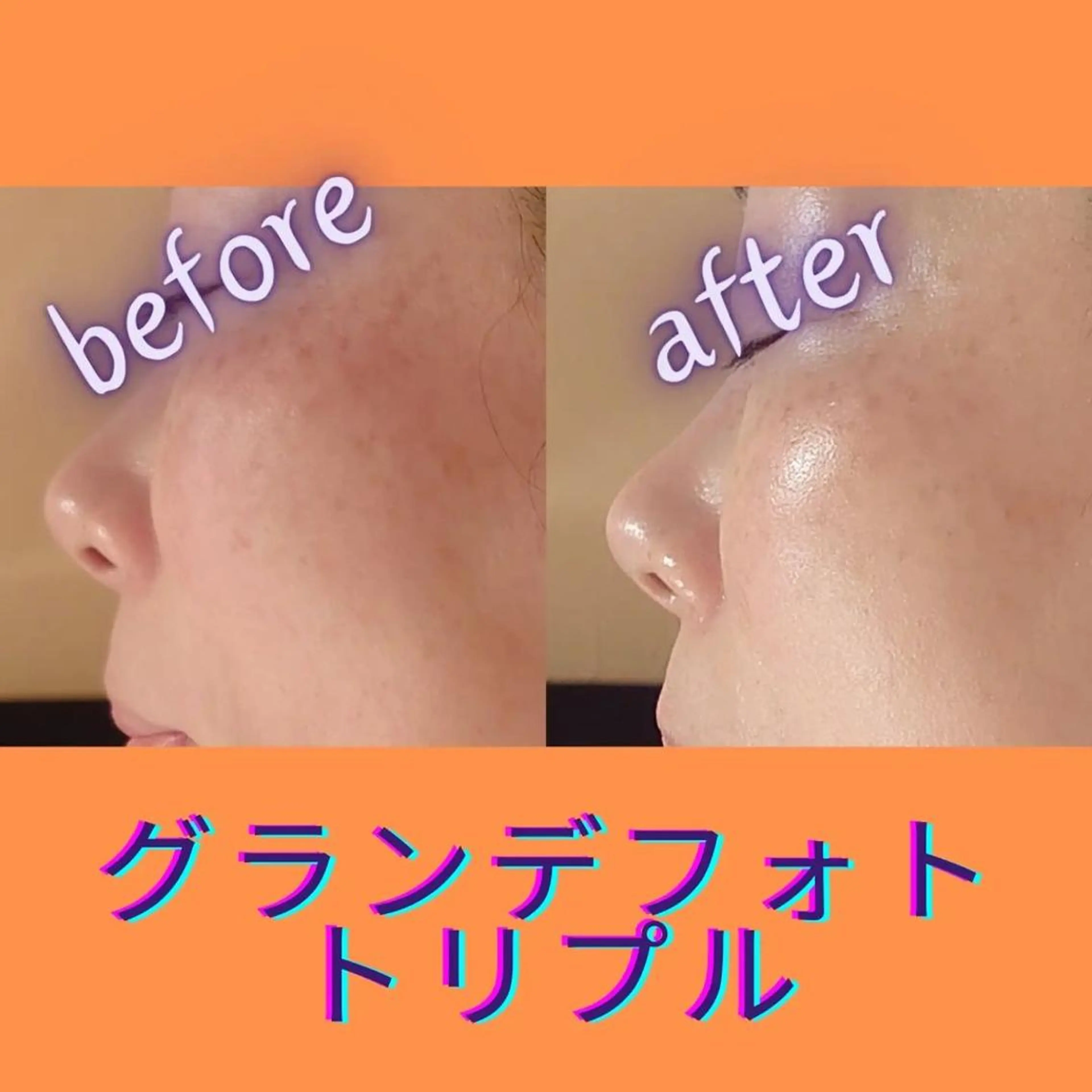 ラブニール 恵比寿店のエステ・リラクイメージ