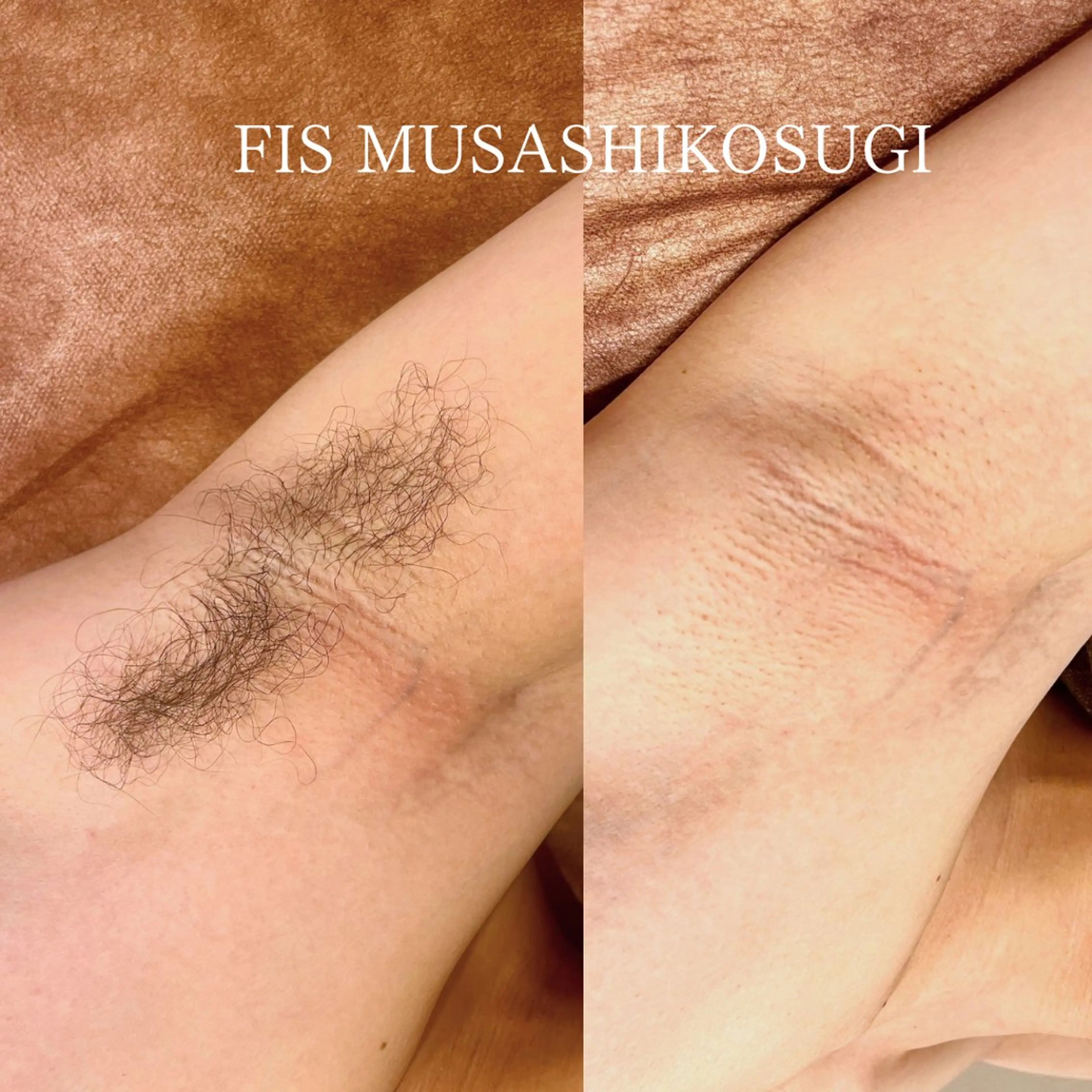 脱毛サロン&ハーブピーリングFIS武蔵小杉店所属・脱毛サロン FIS武蔵小杉店のエステ・リラクイメージ