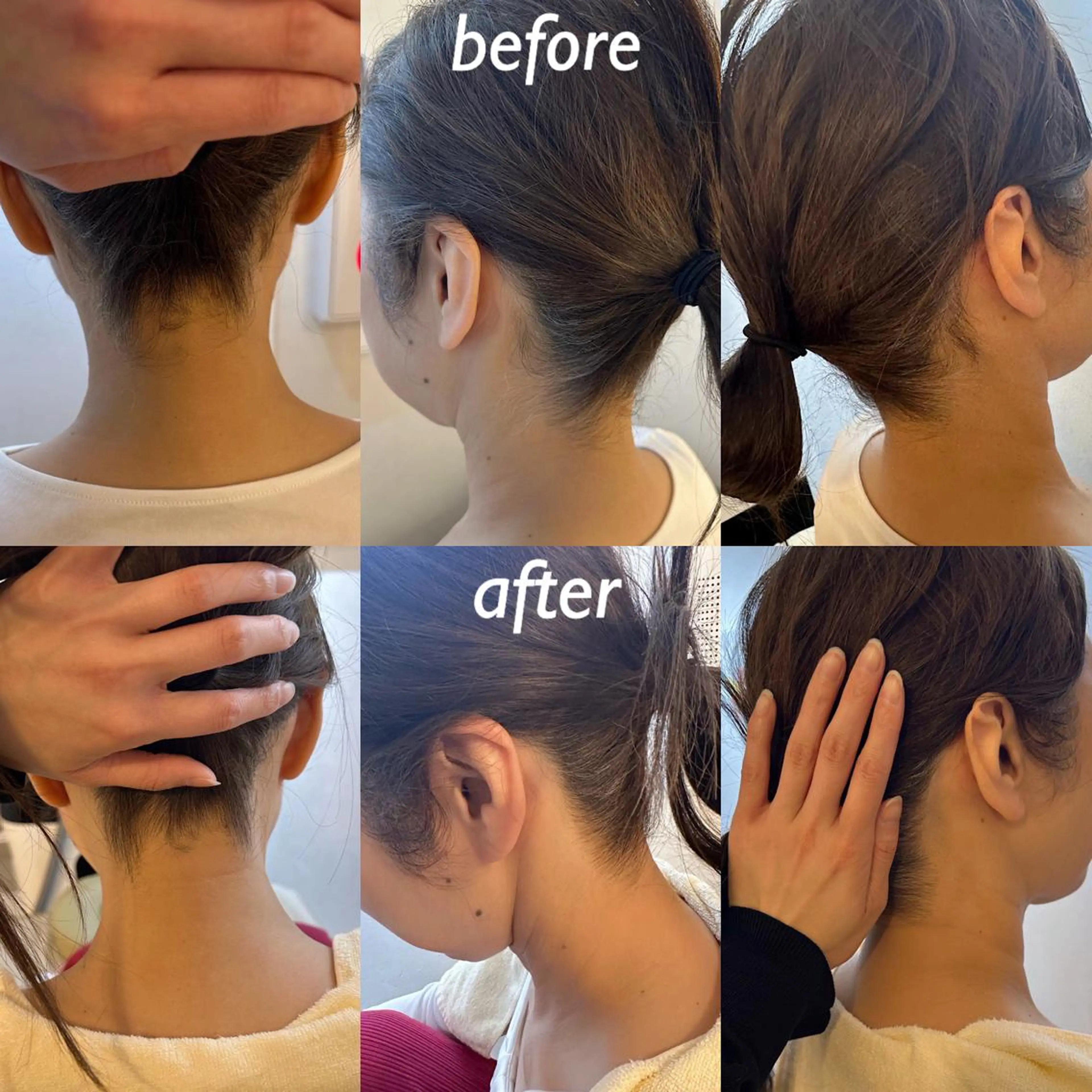 うなじ脱毛/美肌脱毛 LABELのエステ・リラクイメージ