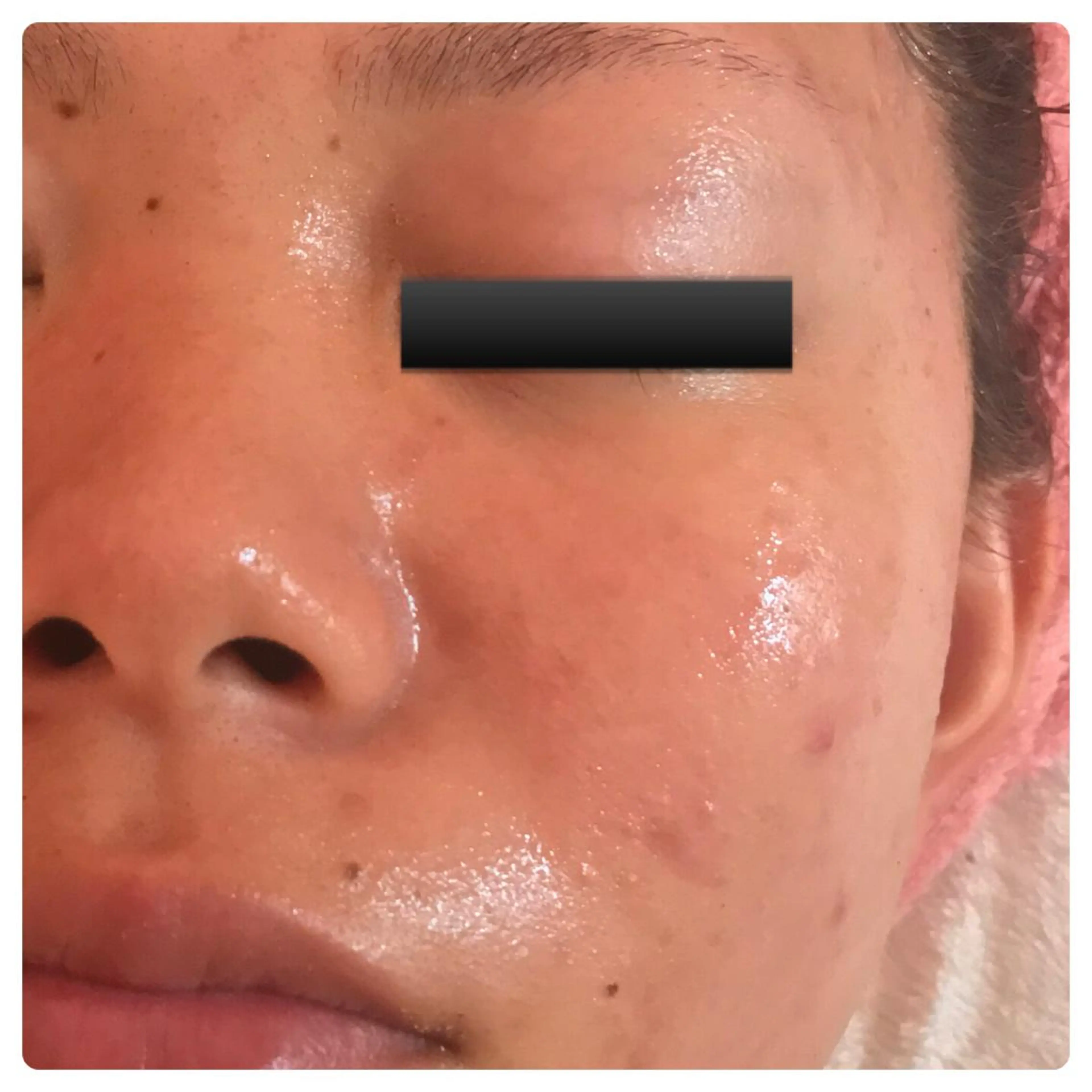 フェアリーローズ所属・fairyrose organicエステのエステ・リラクイメージ