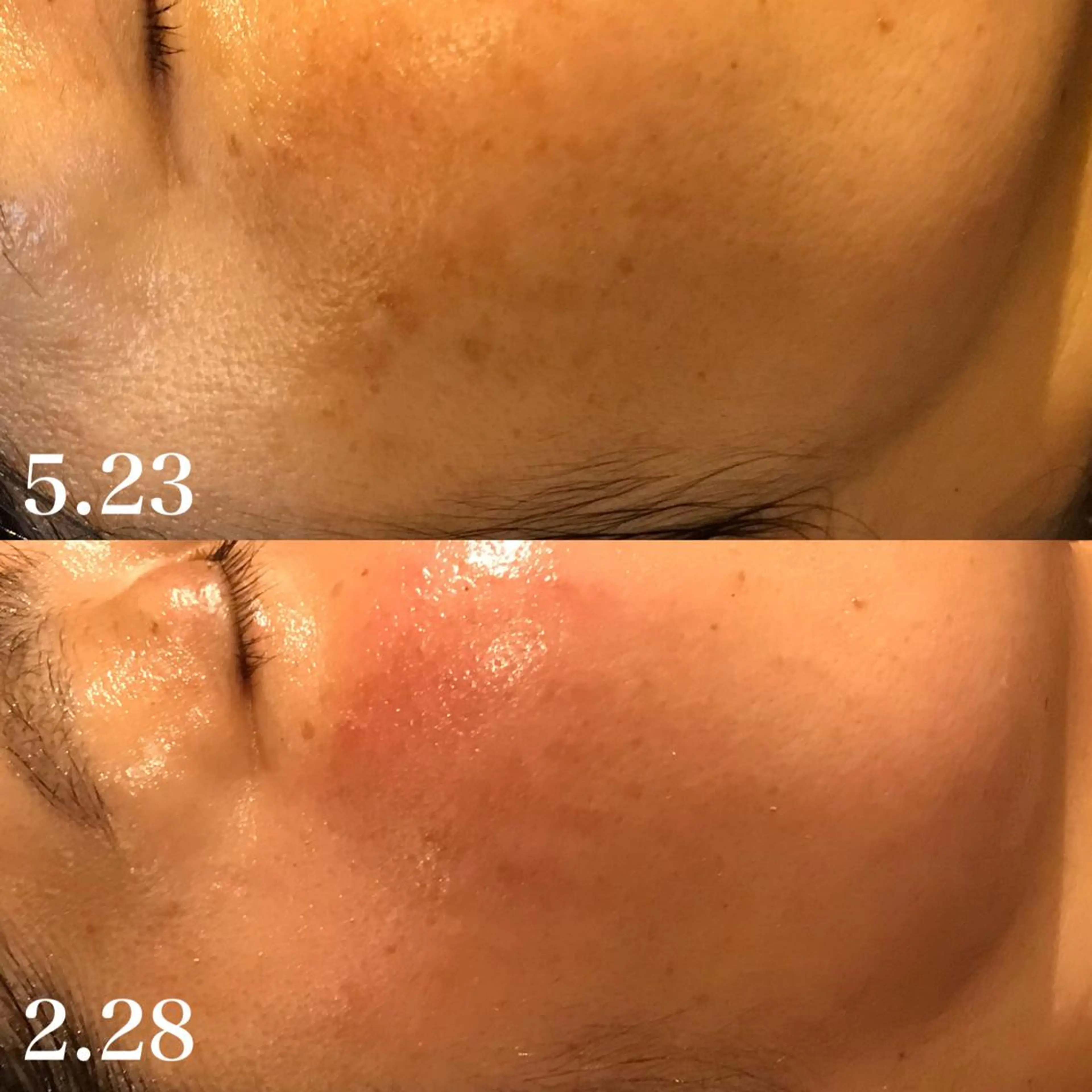 エステ 浜野 恵美のエステ・リラクイメージ