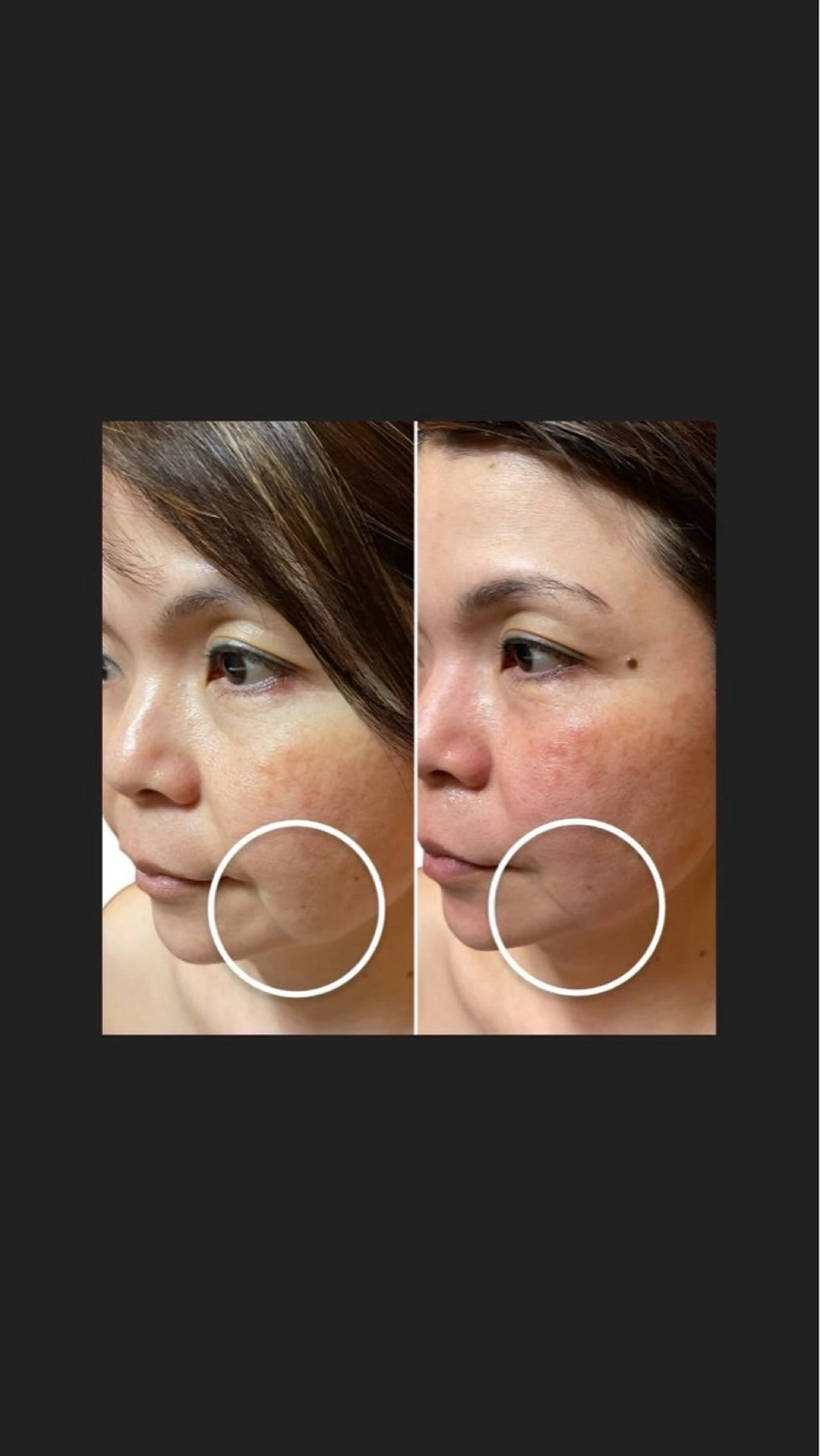 エステ アピタ千代田橋店 POLA THE BEAUTY所属・アピタ千代田橋店 ポーラ 楊のエステ・リラクイメージ