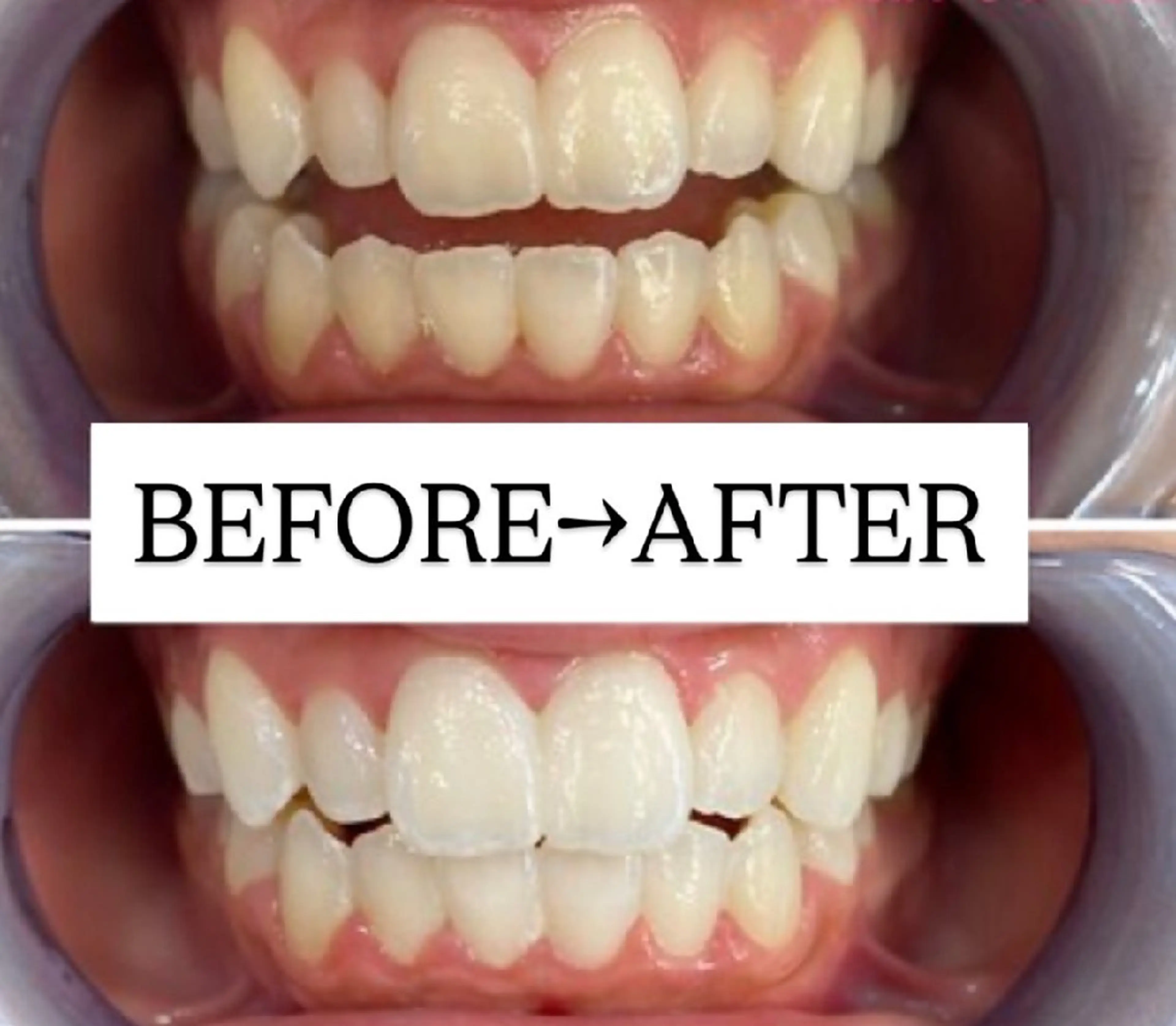 箕浦 乙葉のその他イメージ