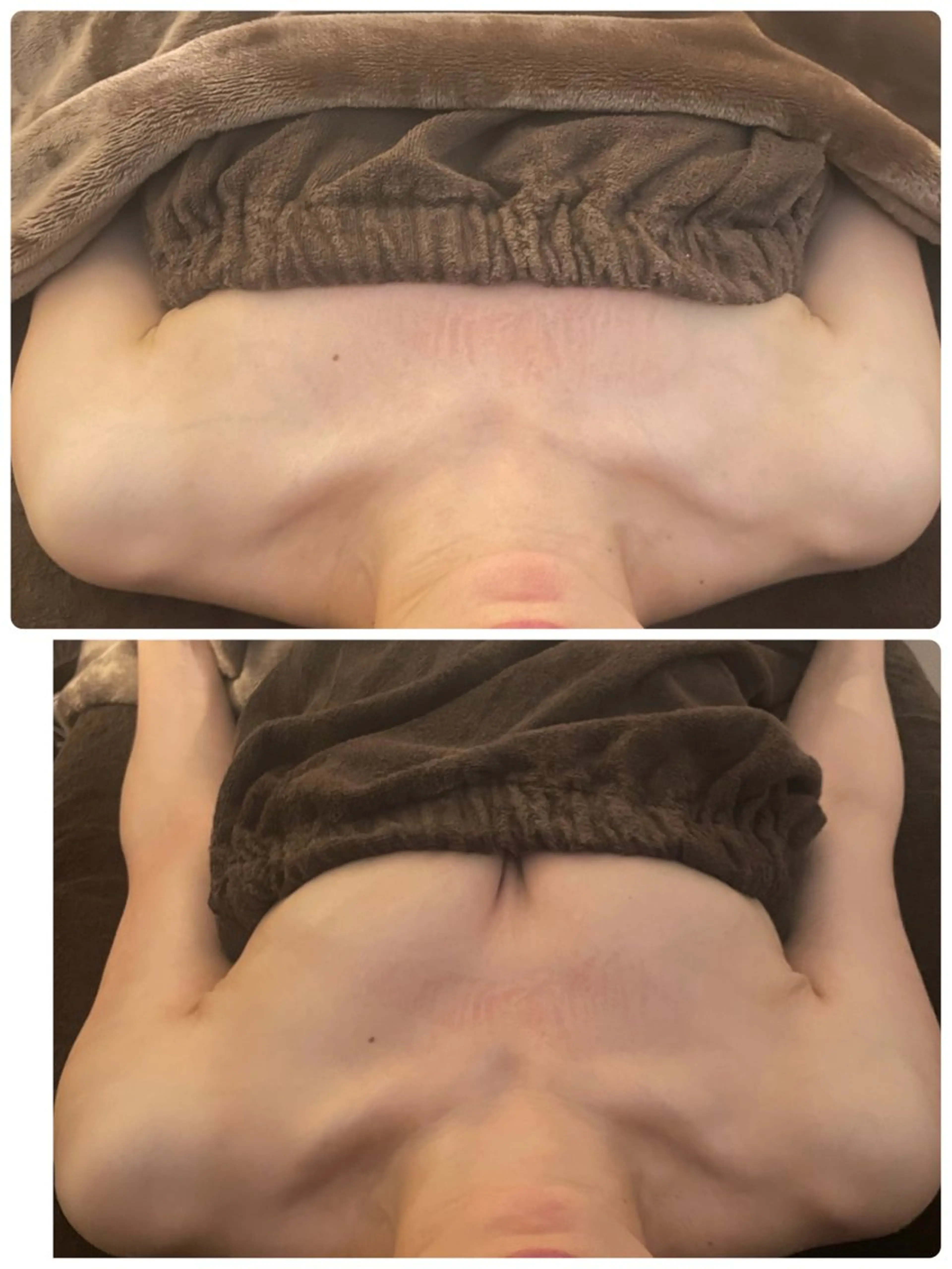 美人スイッチdiet スーパージェクションのその他イメージ