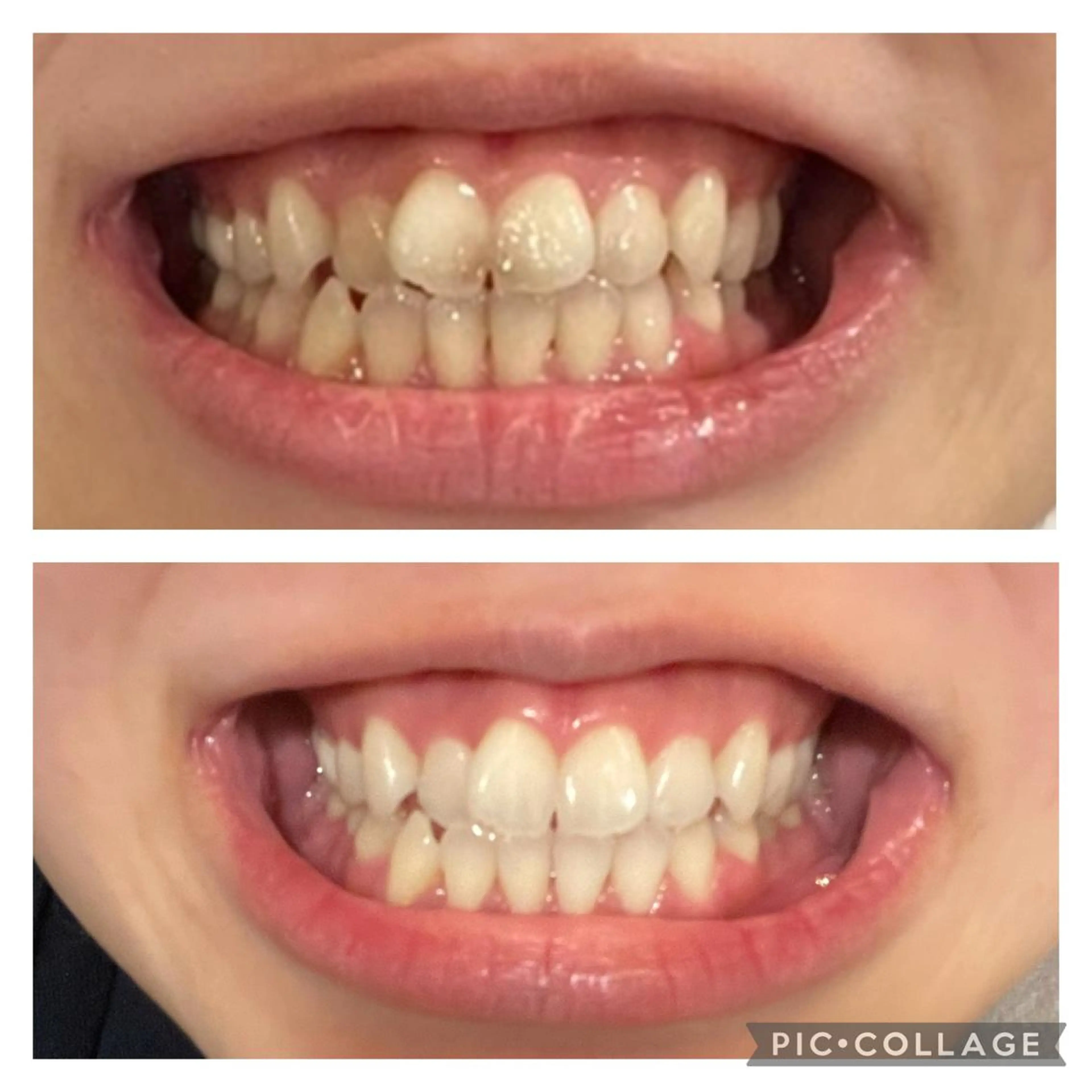 その他 まつ毛パーマ×脱毛 スリーズララ🌼の眉毛・アイブロウイメージ