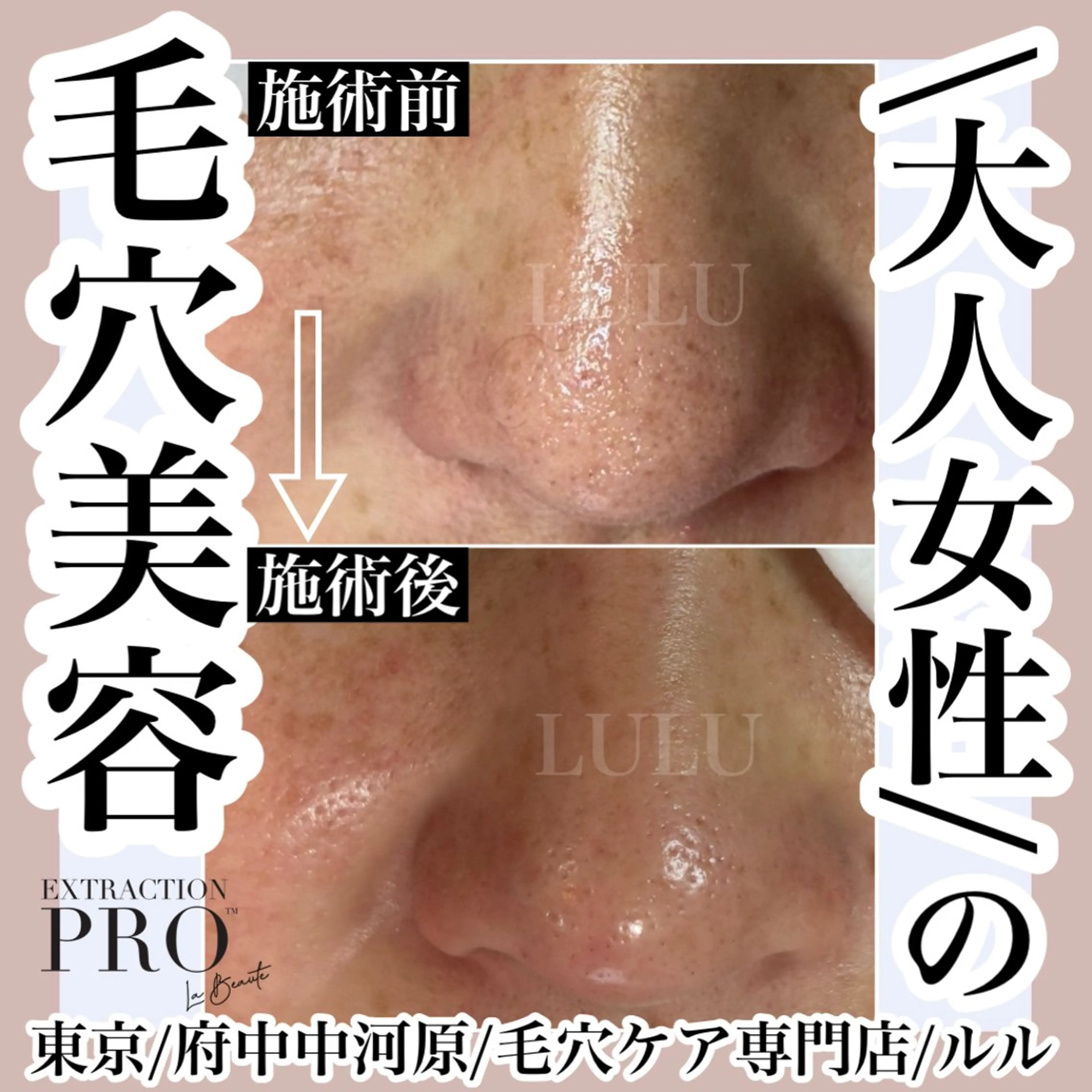 その他 LULU ルルのエステ・リラクイメージ