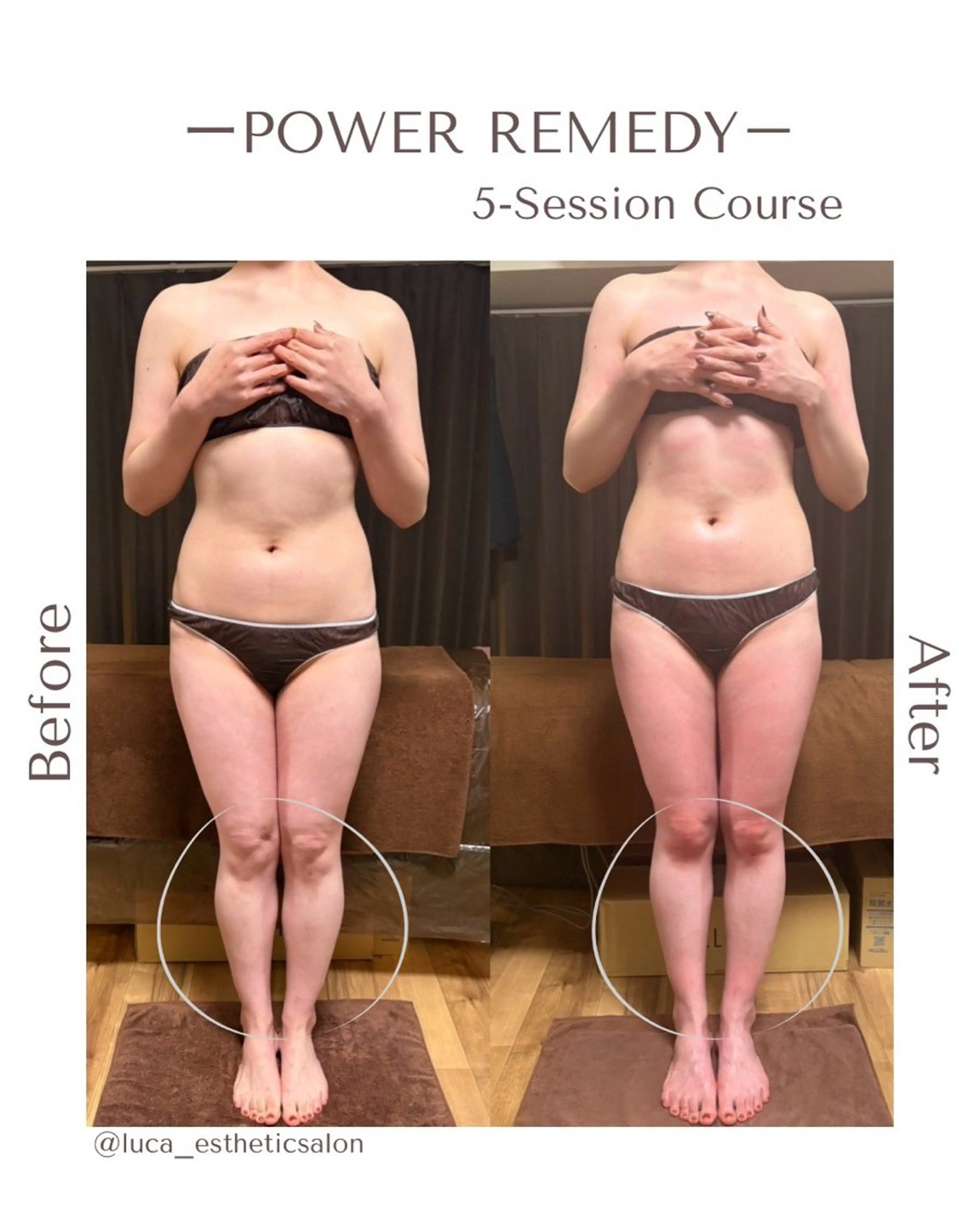 エステ リラク Luca 痩身• 疲労改善×韓国肌管理のエステ・リラクイメージ