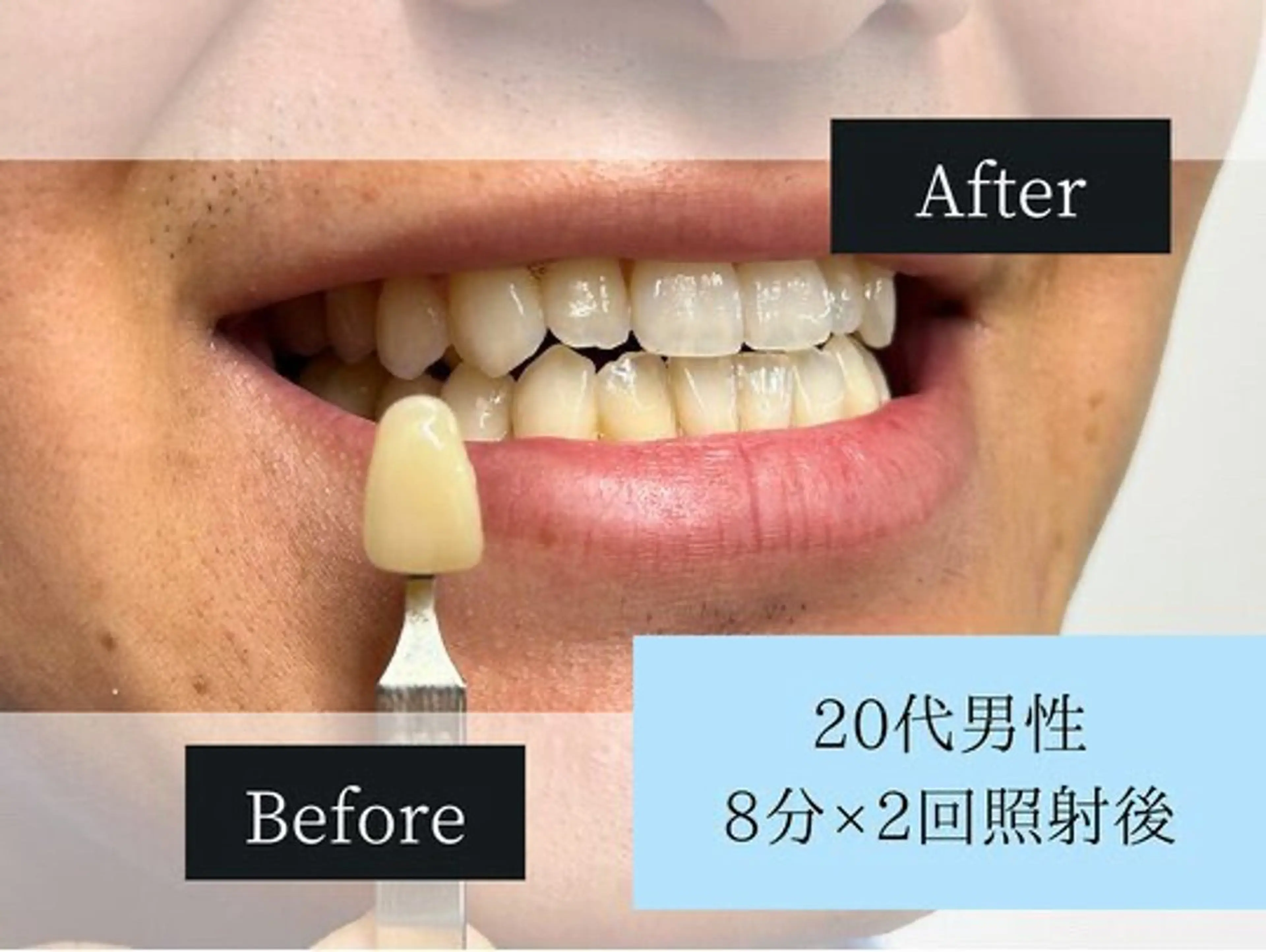 ホワイトニングカフェ 原宿店のエステ・リラクイメージ