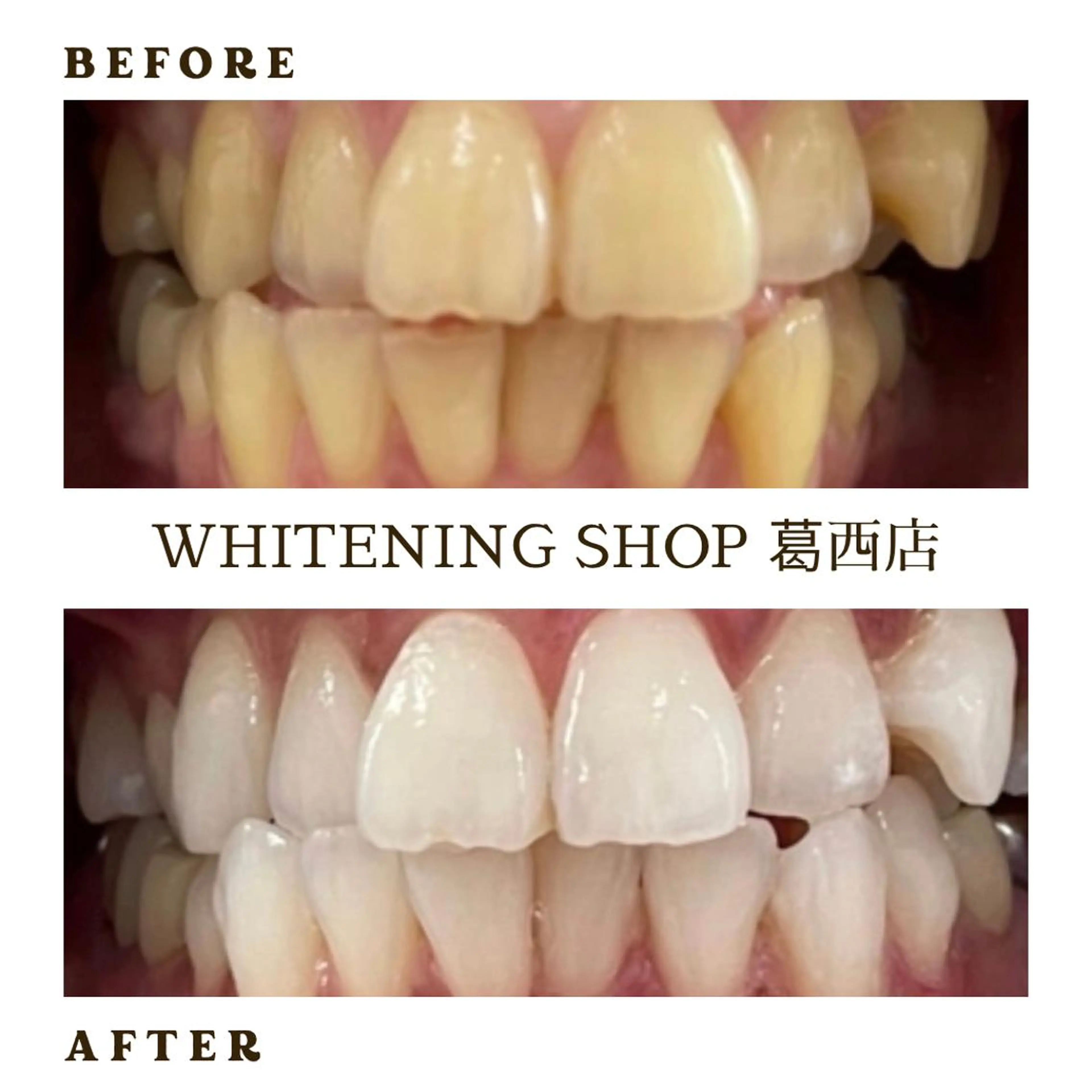 メンズ その他 ホワイトニング ショップ葛西店のその他イメージ