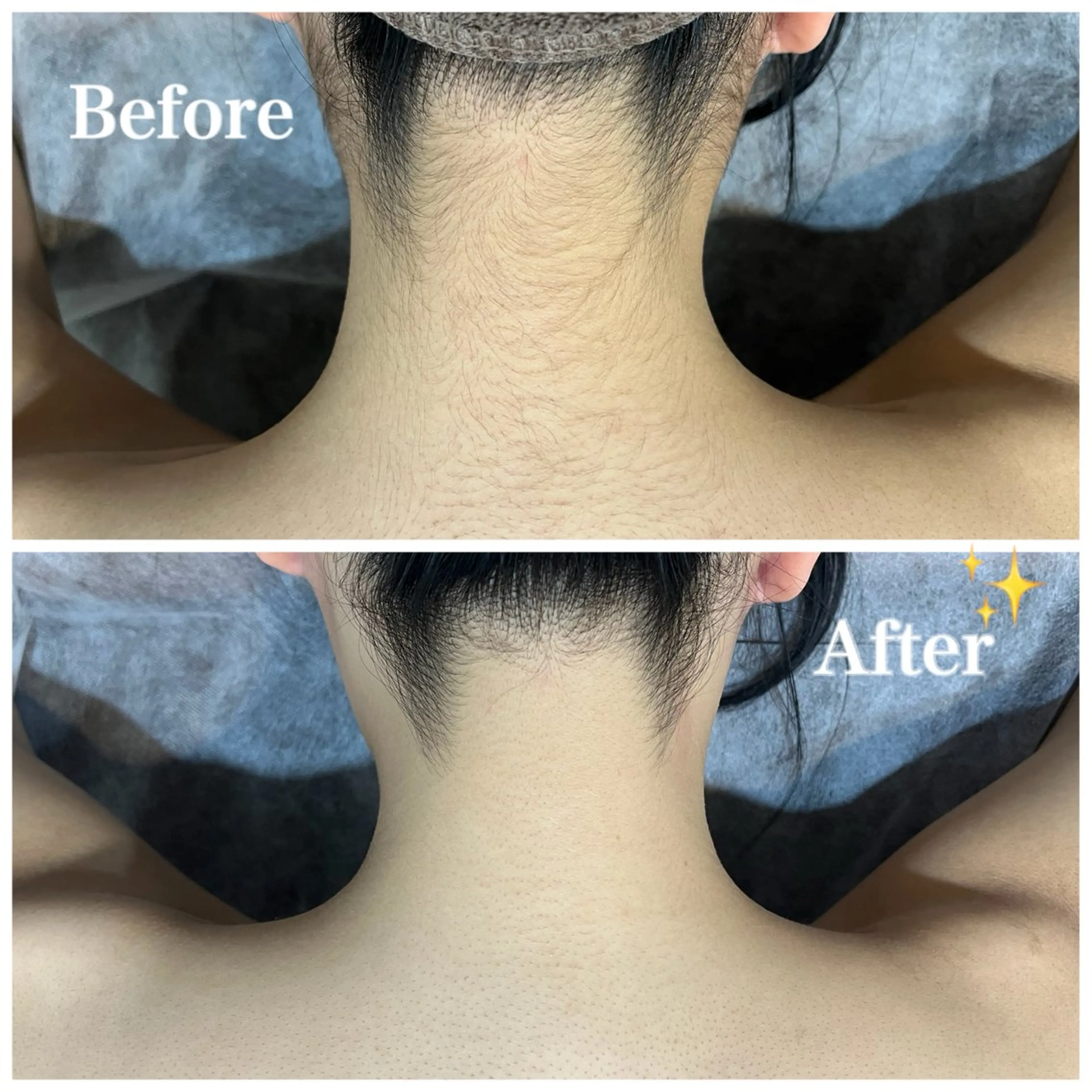 脱毛サロン fam.豊澤柚良のエステ・リラクイメージ