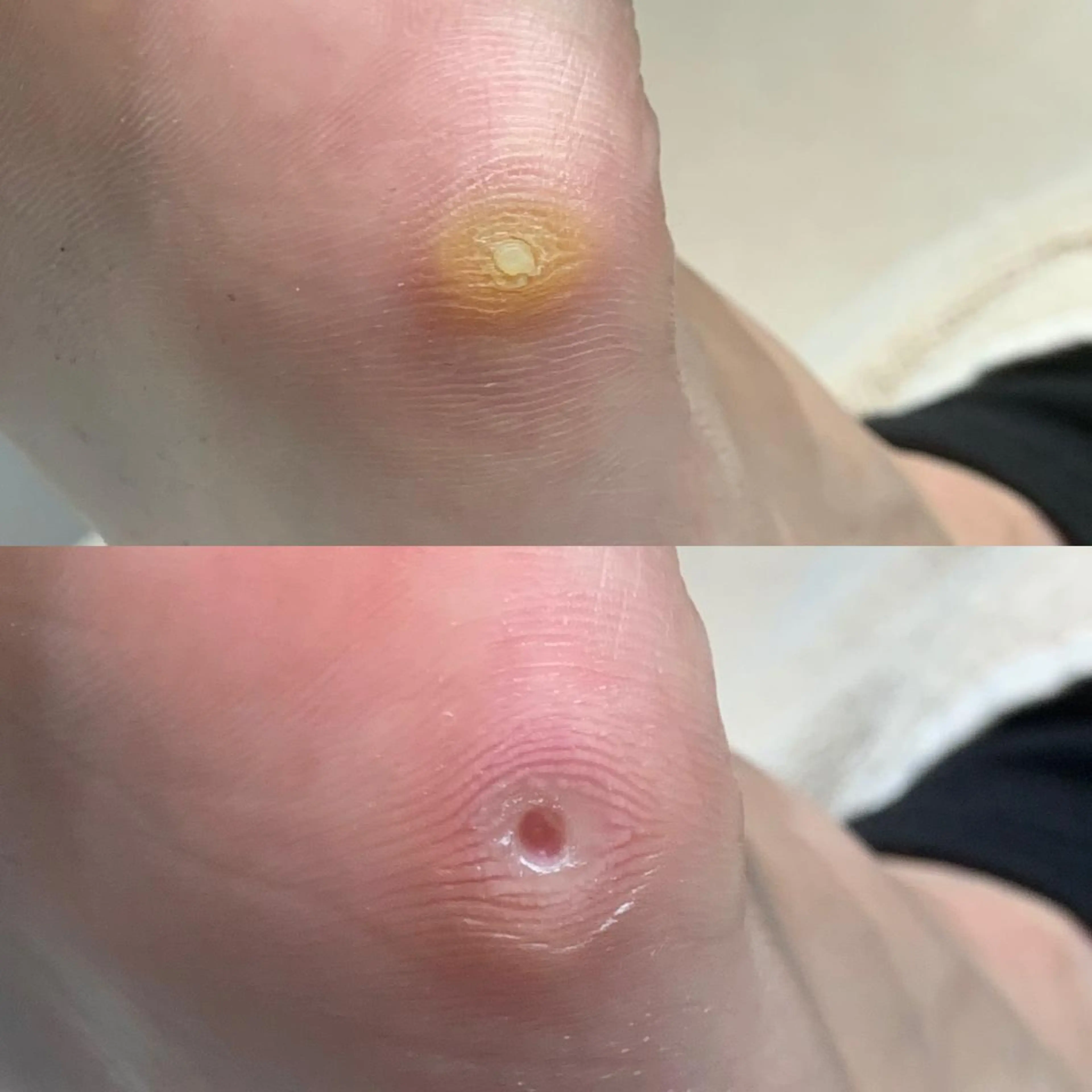 東京巻き爪 アカデミーのエステ・リラクイメージ