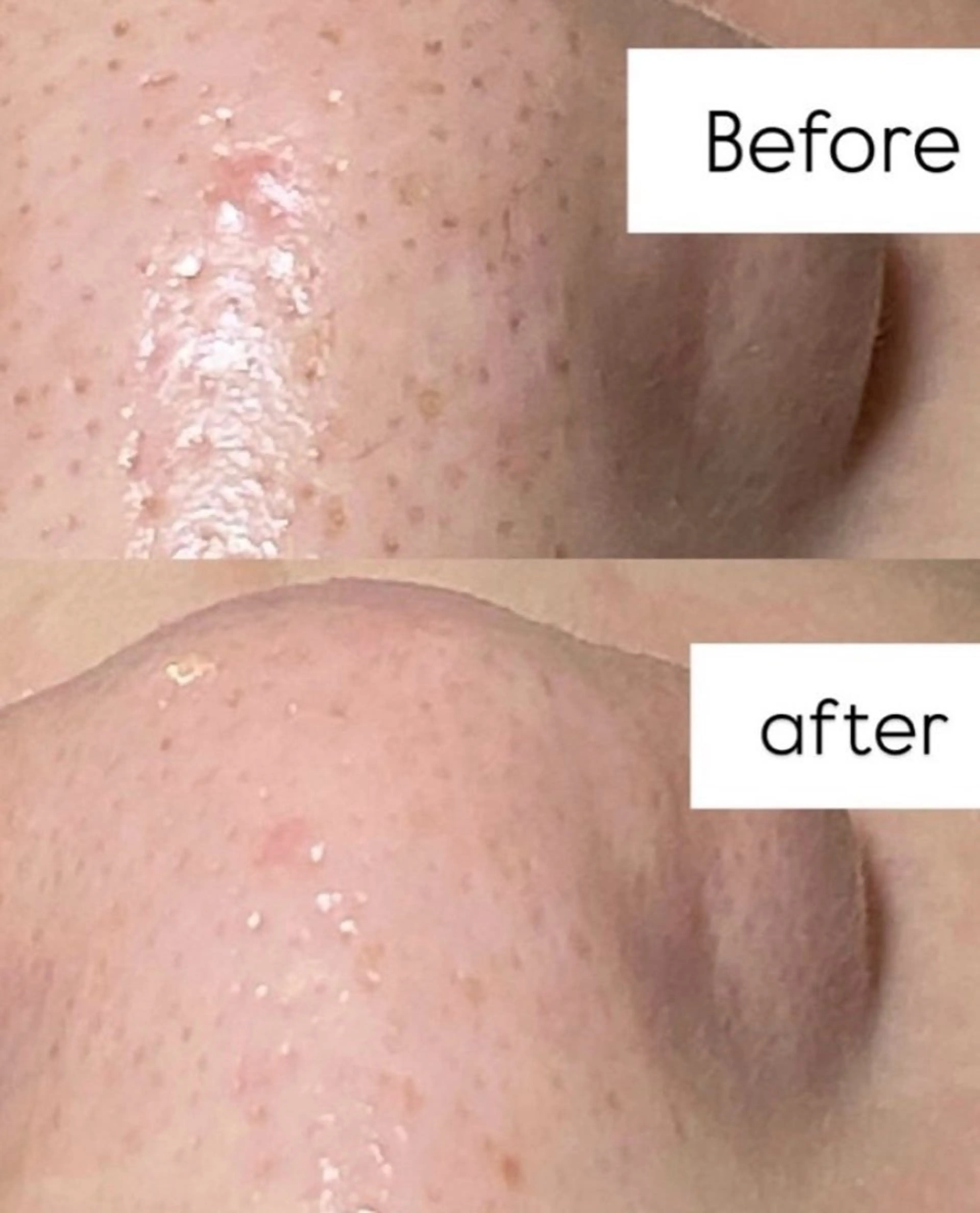 村松/ 小顔,ボディケアのエステ・リラクイメージ