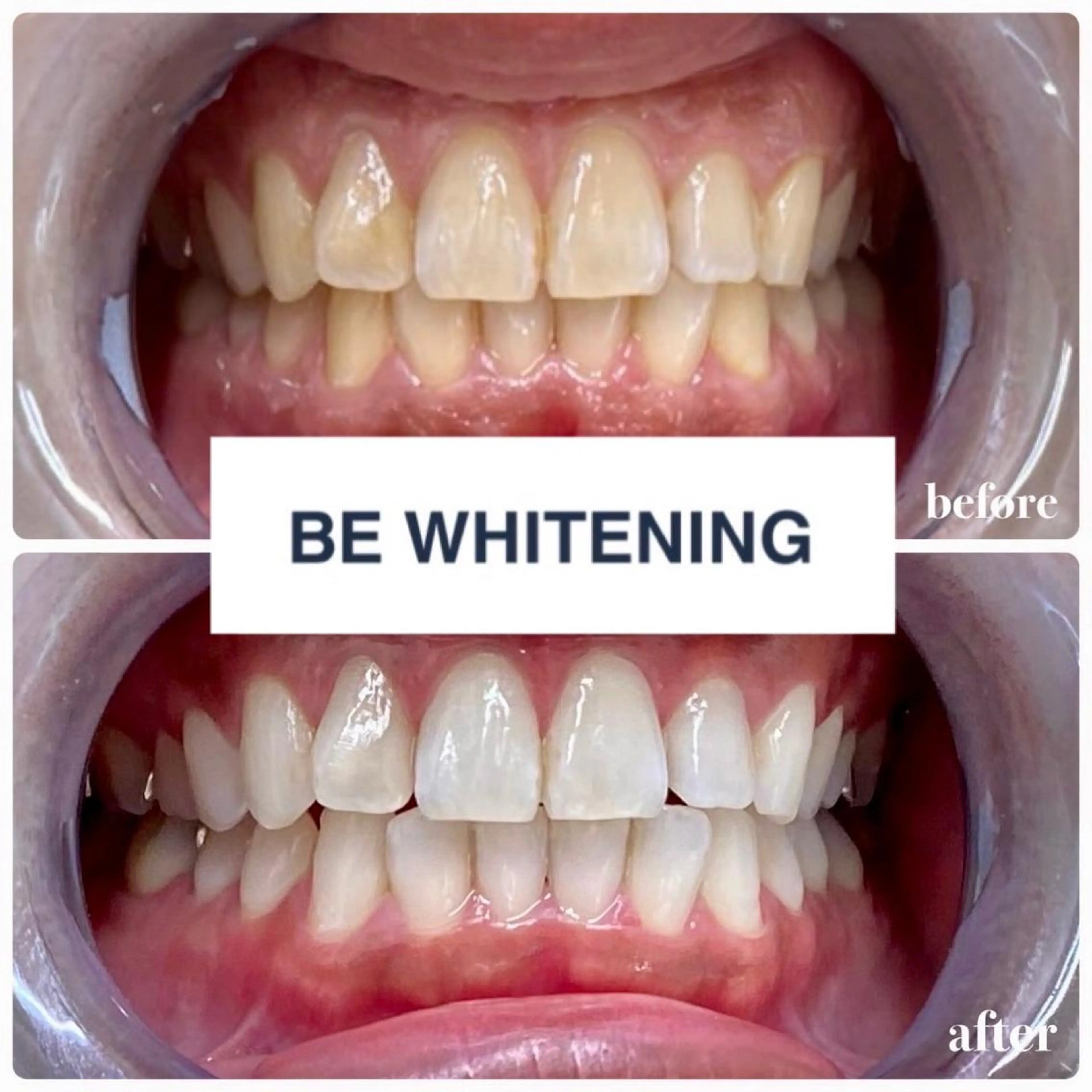 ホワイトニング専門店 ビーホワイト金山のその他イメージ