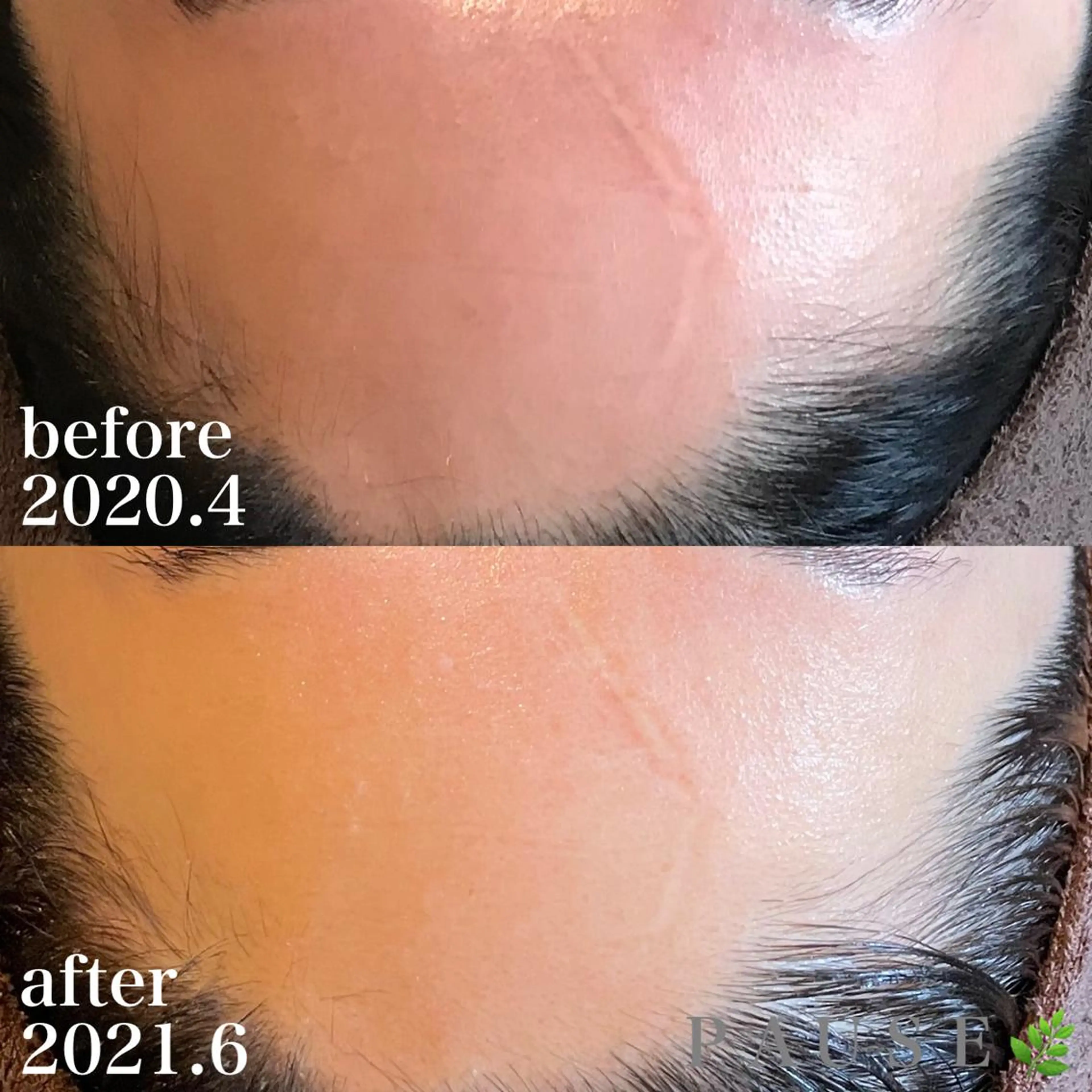 エステ 浜野 恵美のエステ・リラクイメージ