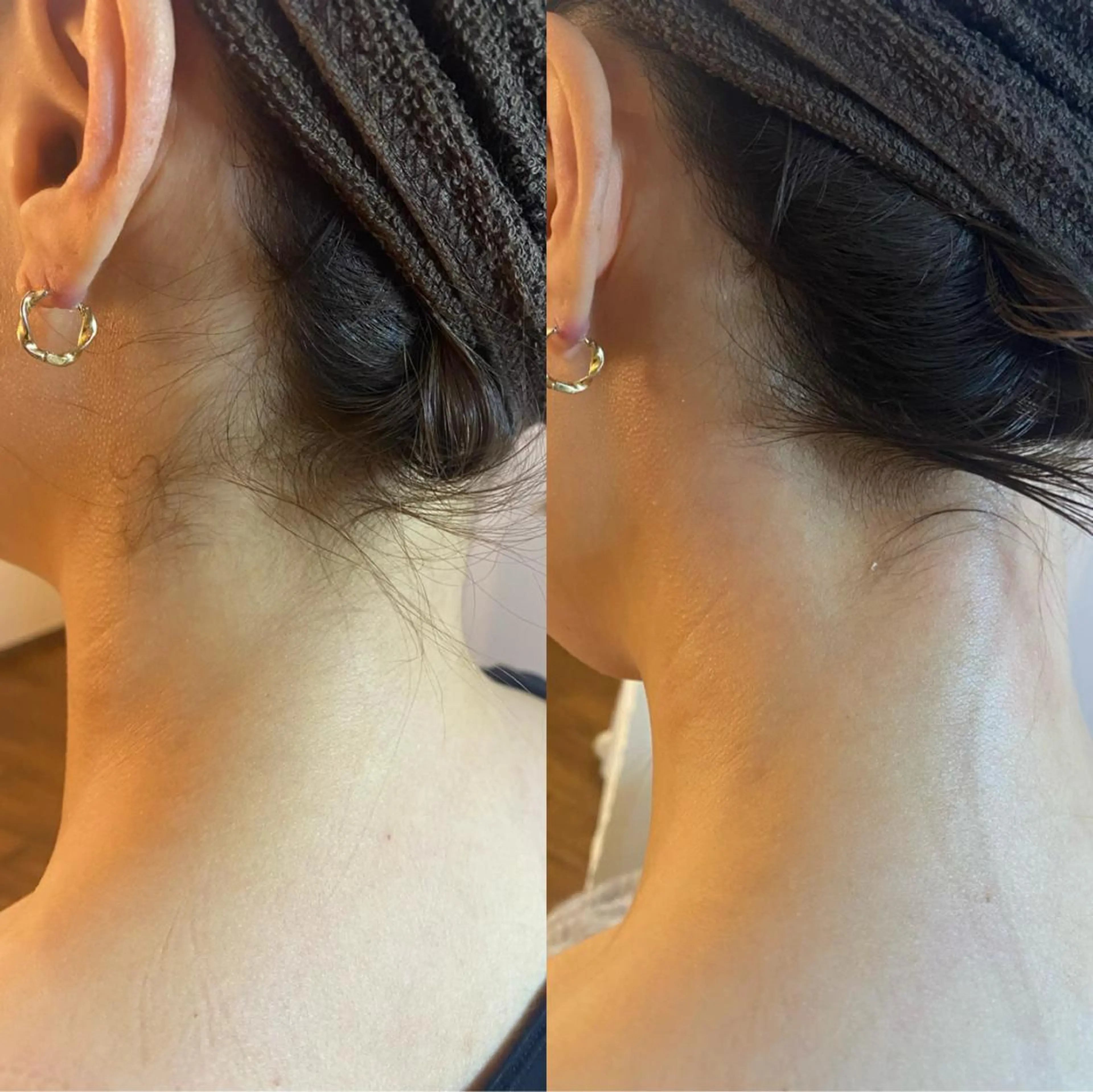 脱毛 BELCIA福岡店 レコルトデベルシアのエステ・リラクイメージ