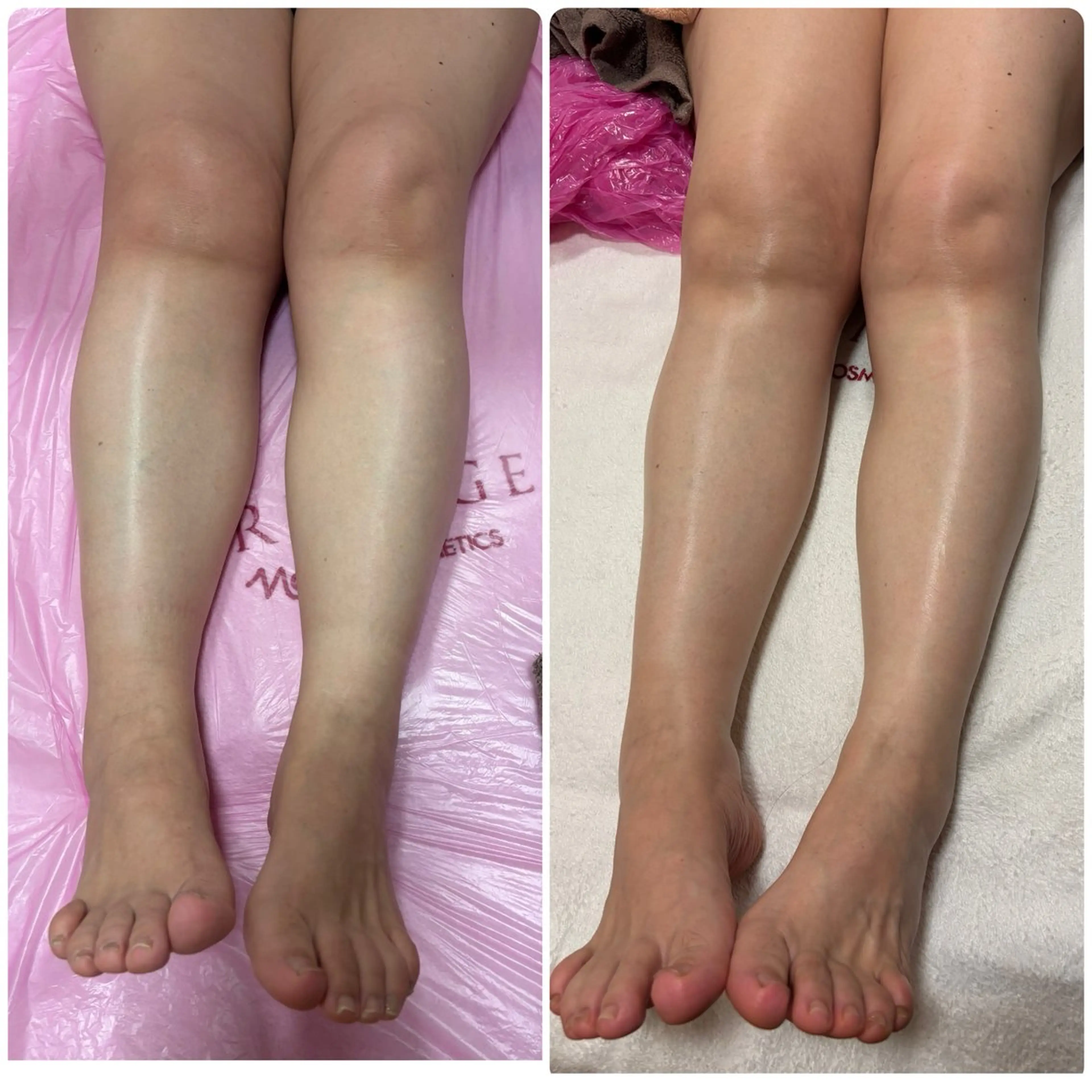 エステ リラク 💆‍♀️松田 亜沙美のエステ・リラクイメージ