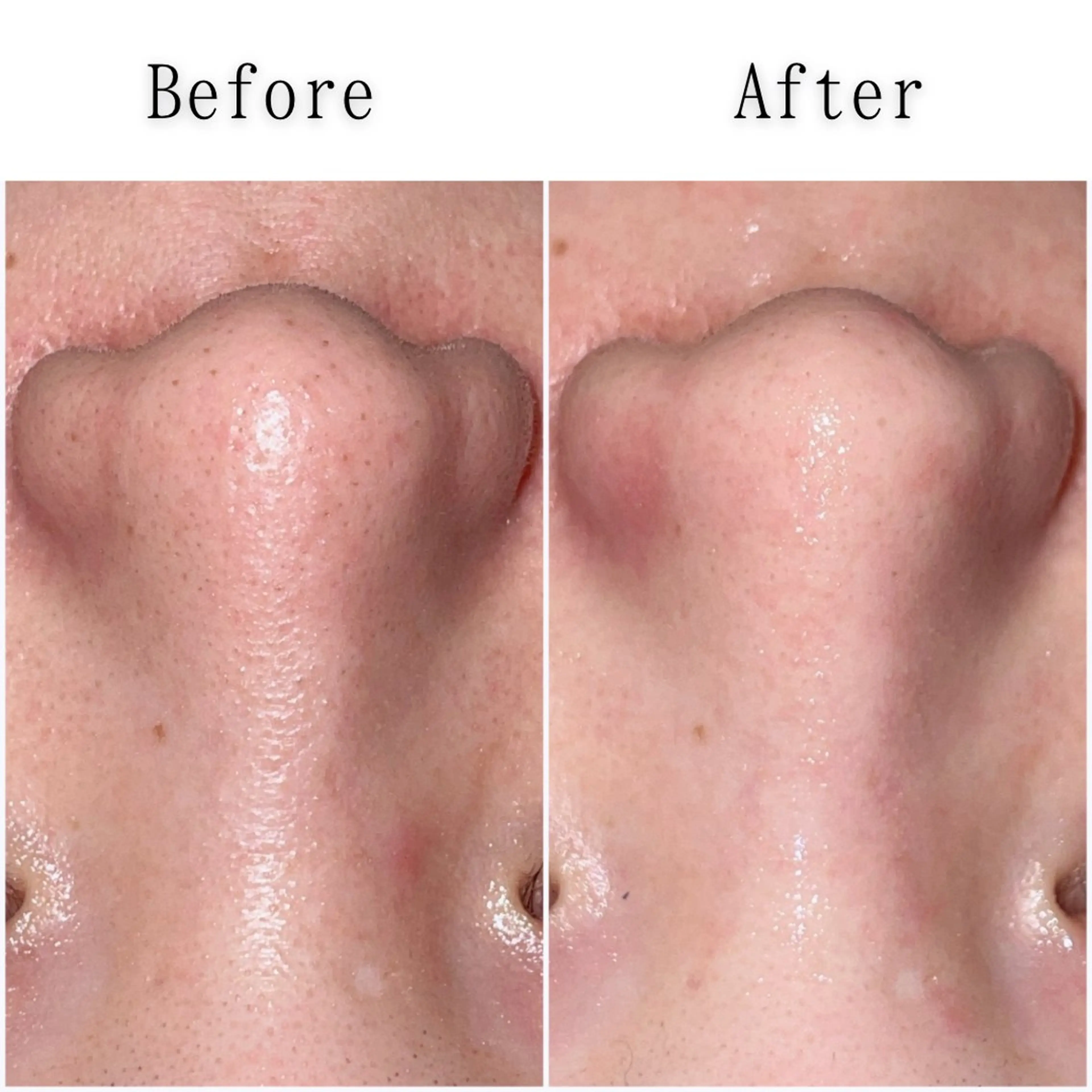 エステ gracia 浦添店のその他イメージ