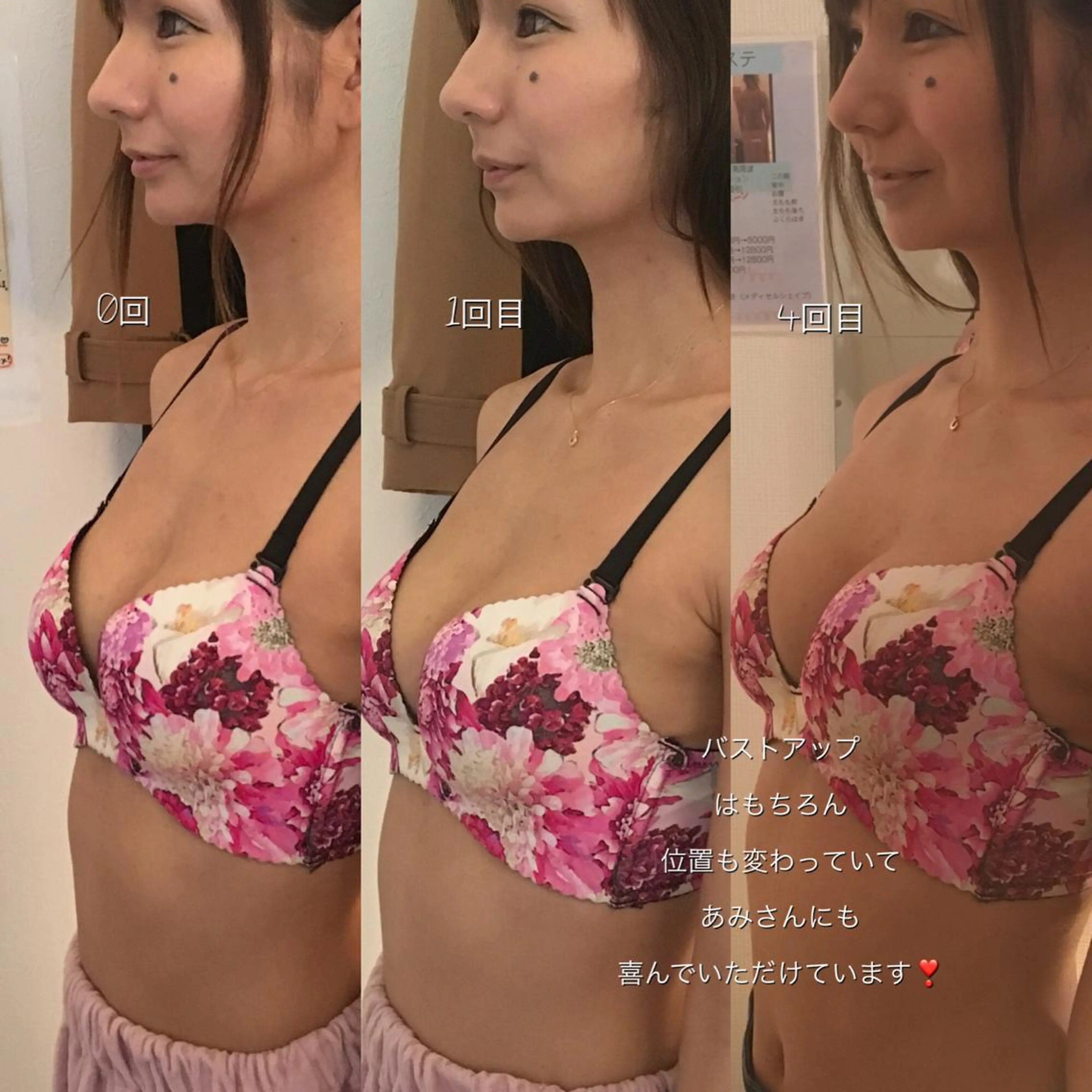 女性のお悩み美容 サロン ヴィーナスのエステ・リラクイメージ