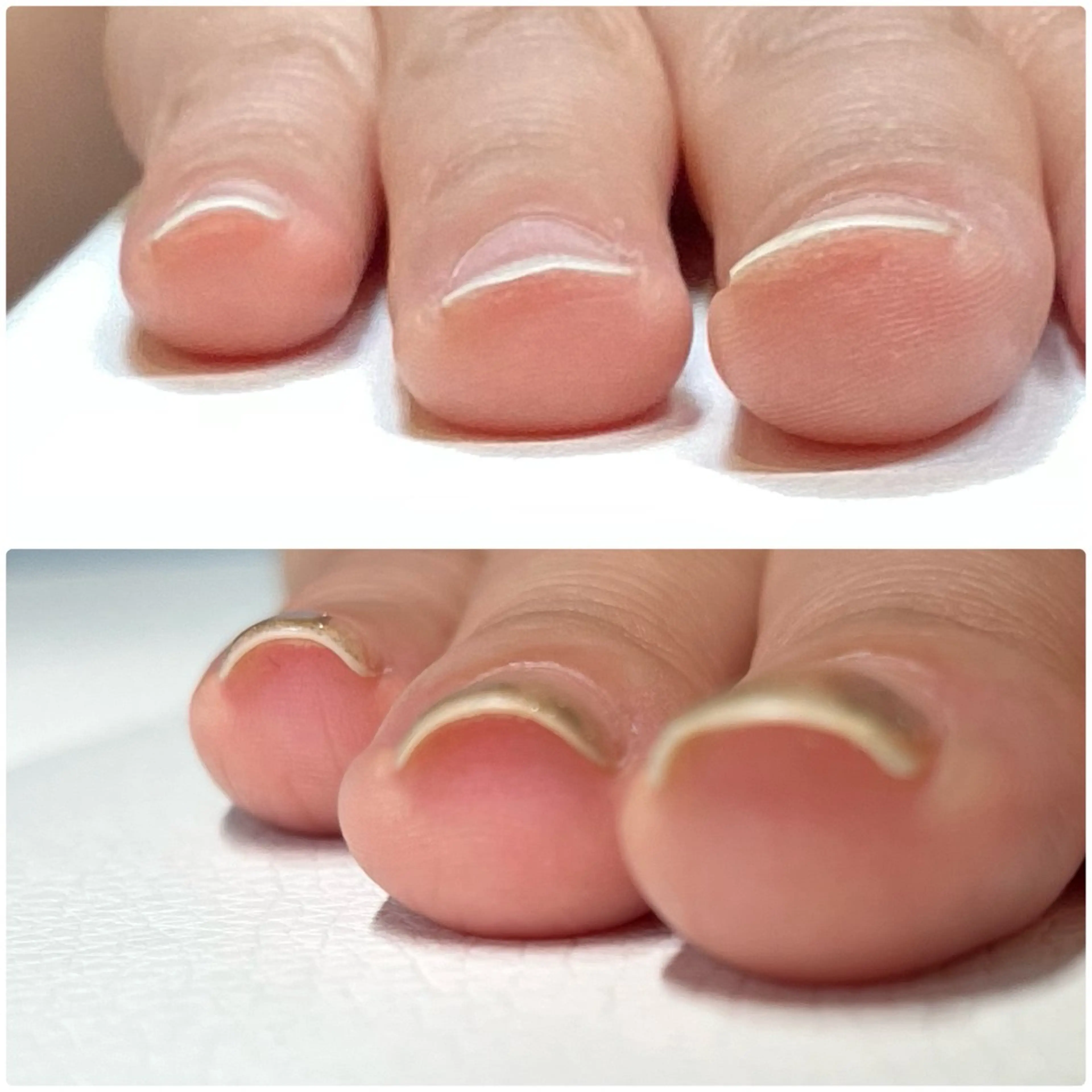 ネイル nailcare リリネルのネイルデザイン