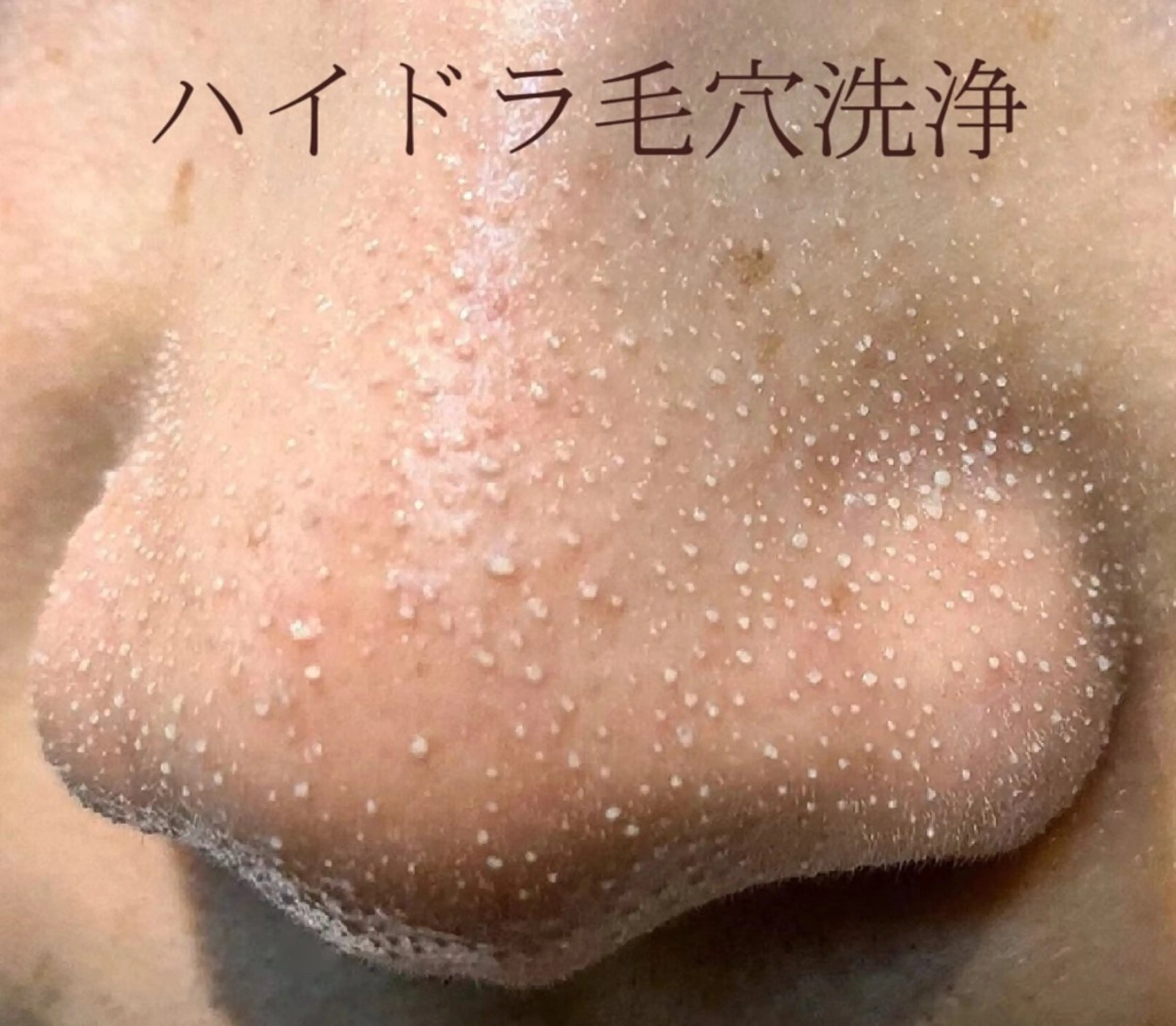 Queen Salonのエステ・リラクイメージ