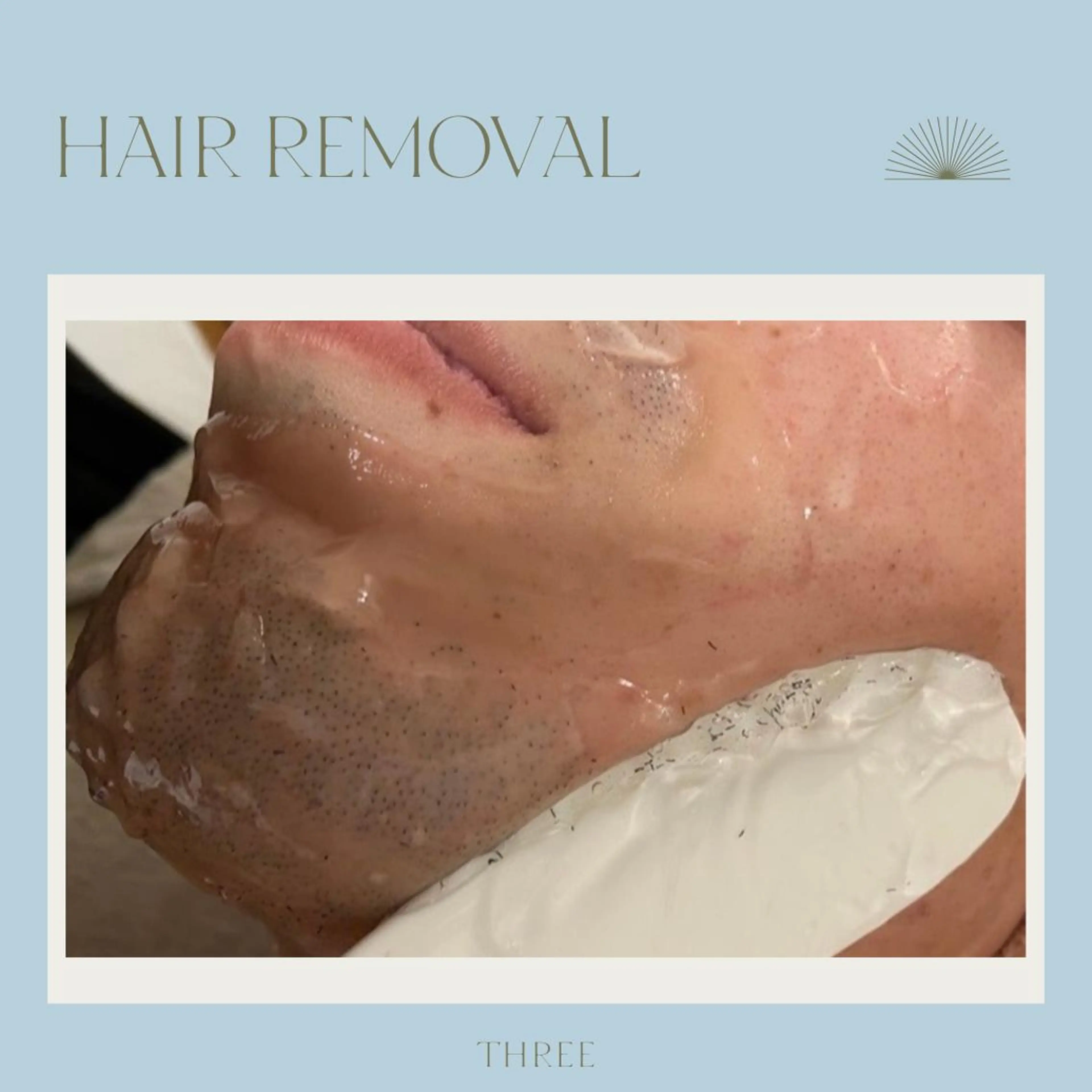 キッズ メンズ 学生（メンズ向け） 脱毛 福留 千春のその他イメージ