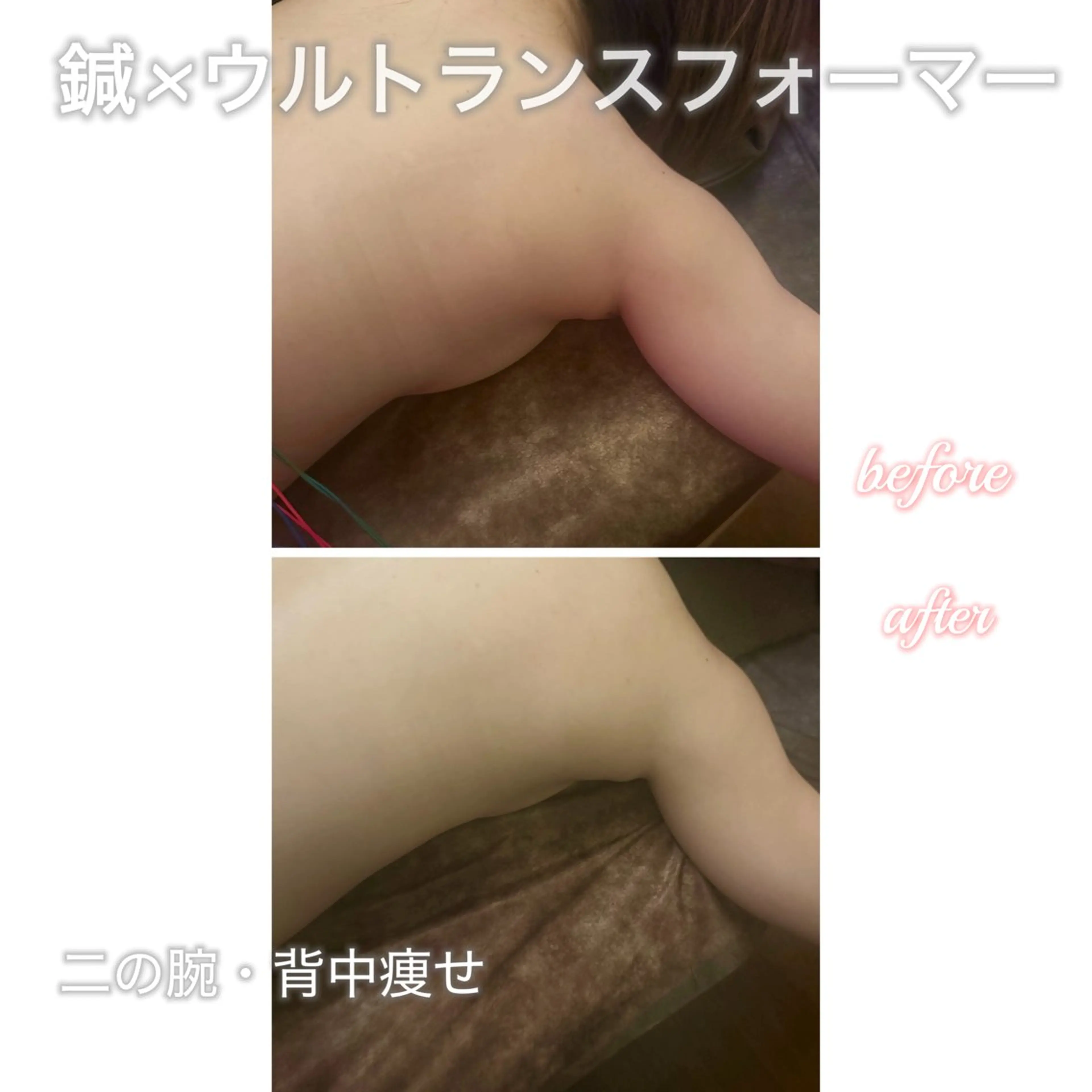 美容鍼灸サロン YOSHINOのエステ・リラクイメージ