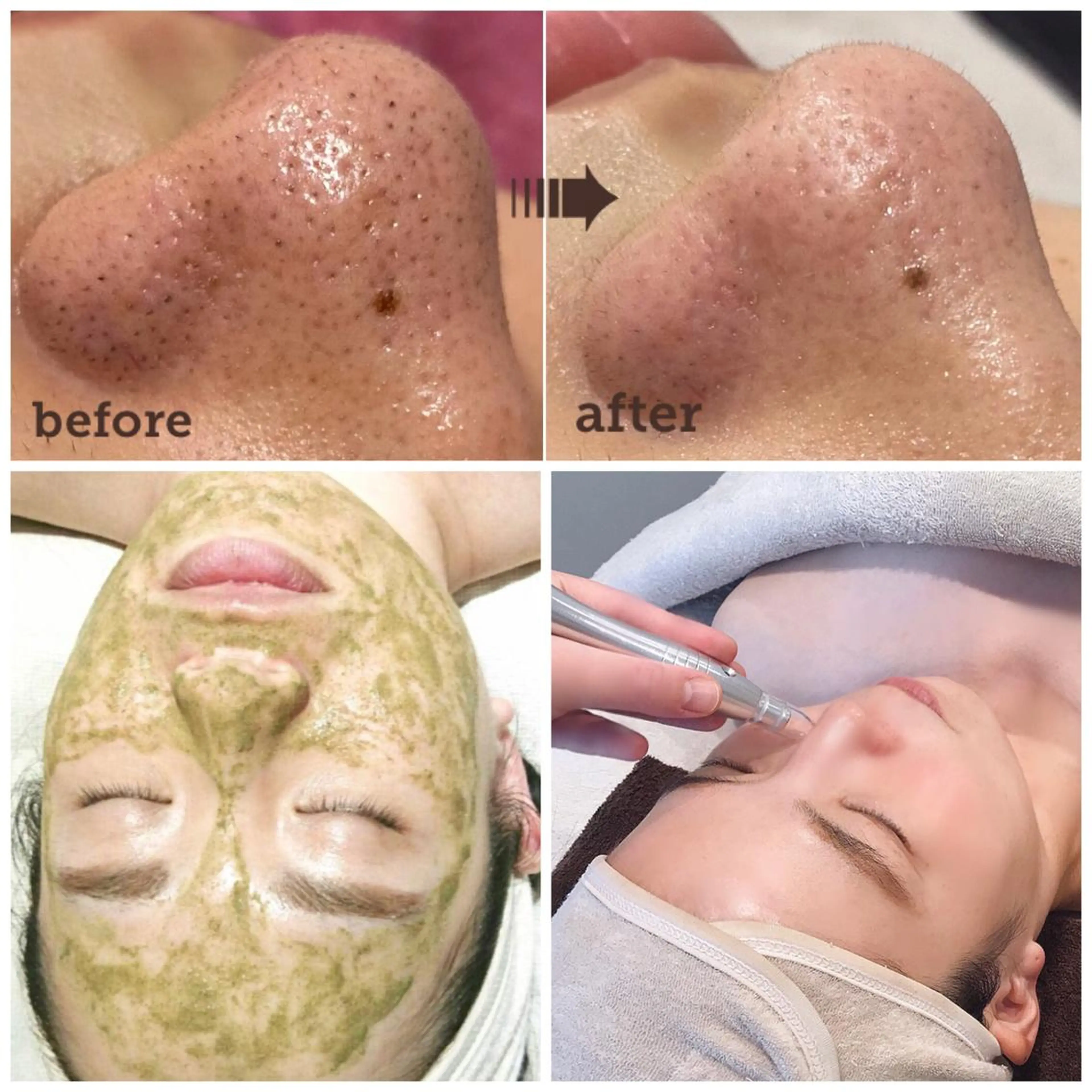 エステサロン JURISのエステ・リラクイメージ