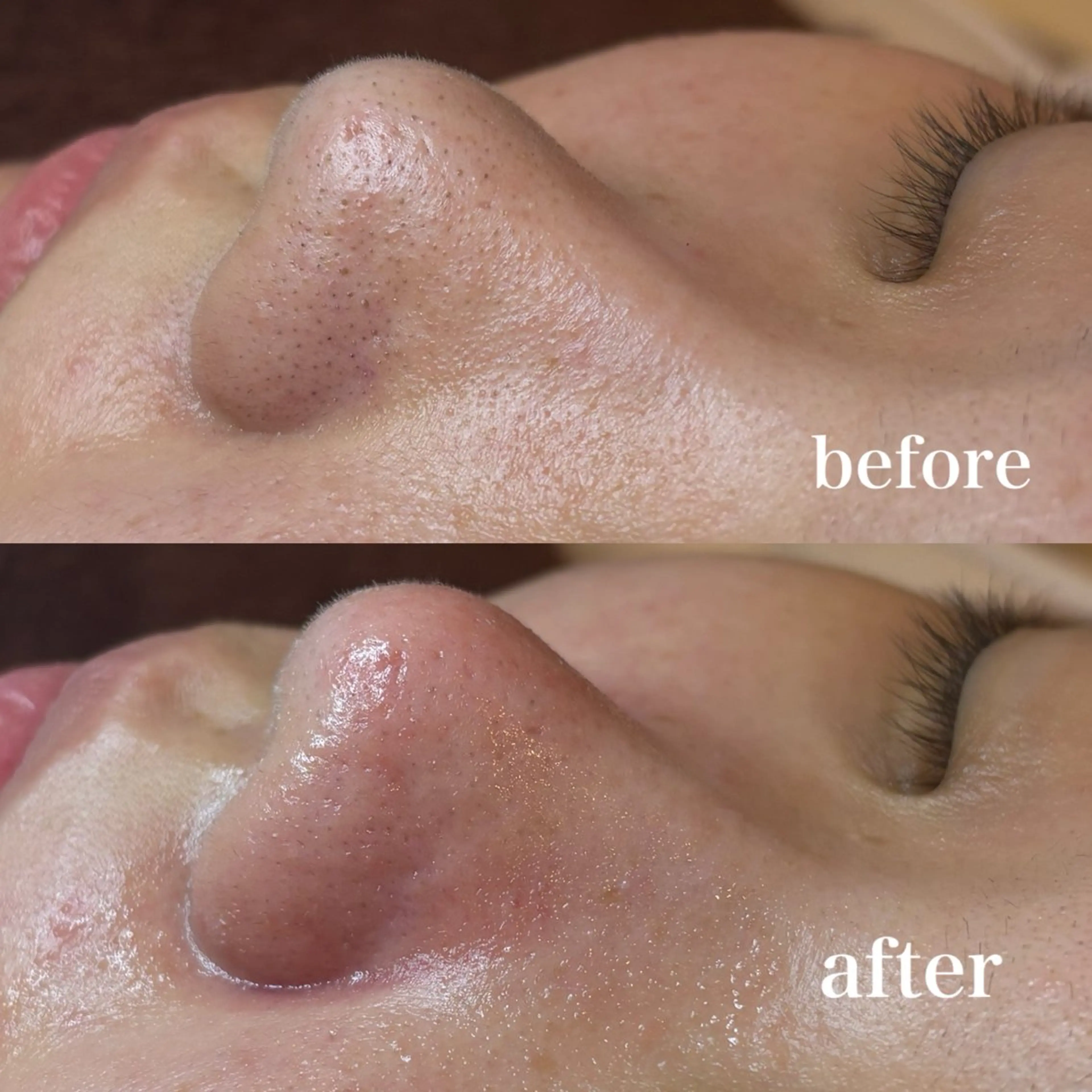 その他 美養HAREHADA 🫧/ Ibukiの眉毛・アイブロウイメージ