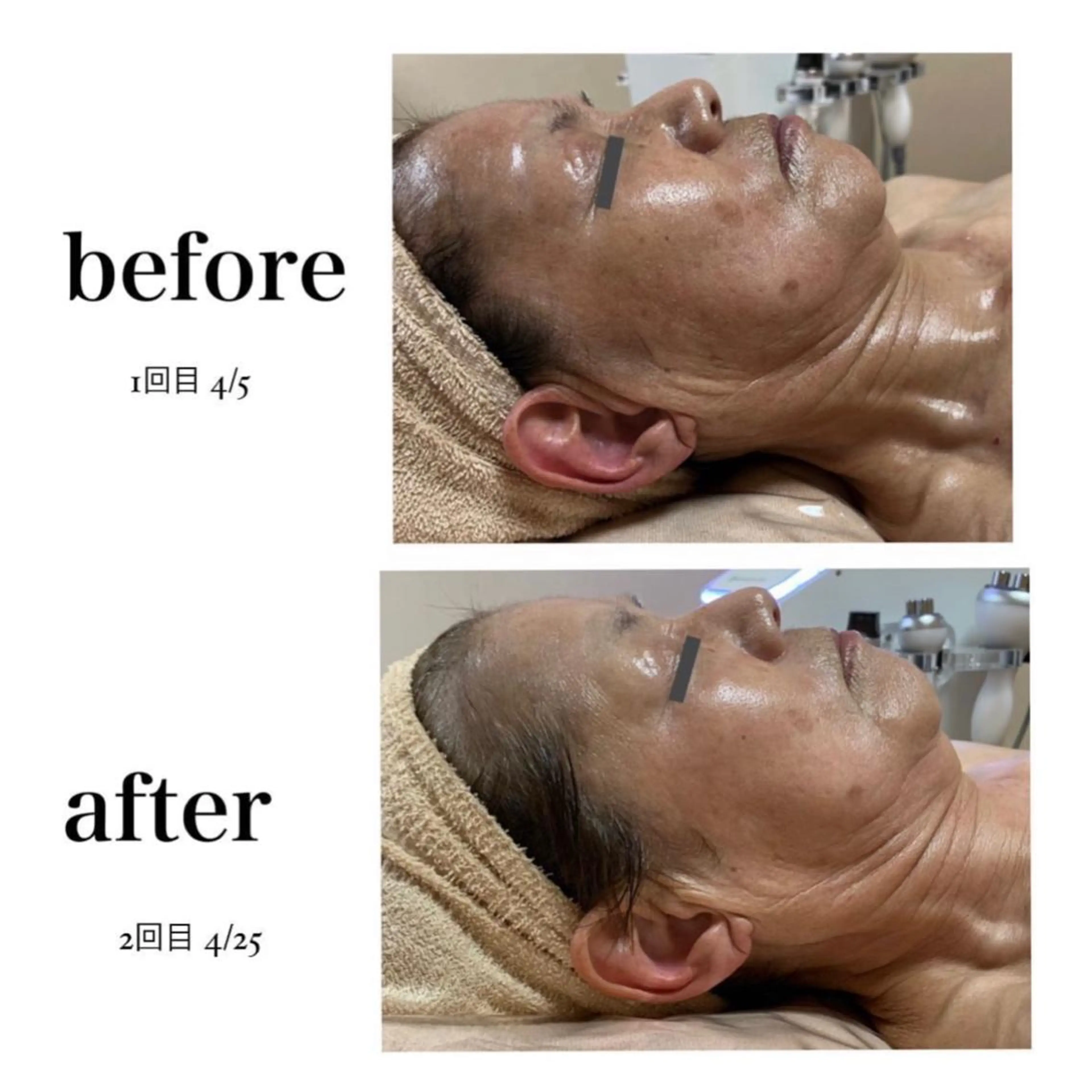 stella都度払い 痩身小顔まつげパーマのマツエク・マツパデザイン