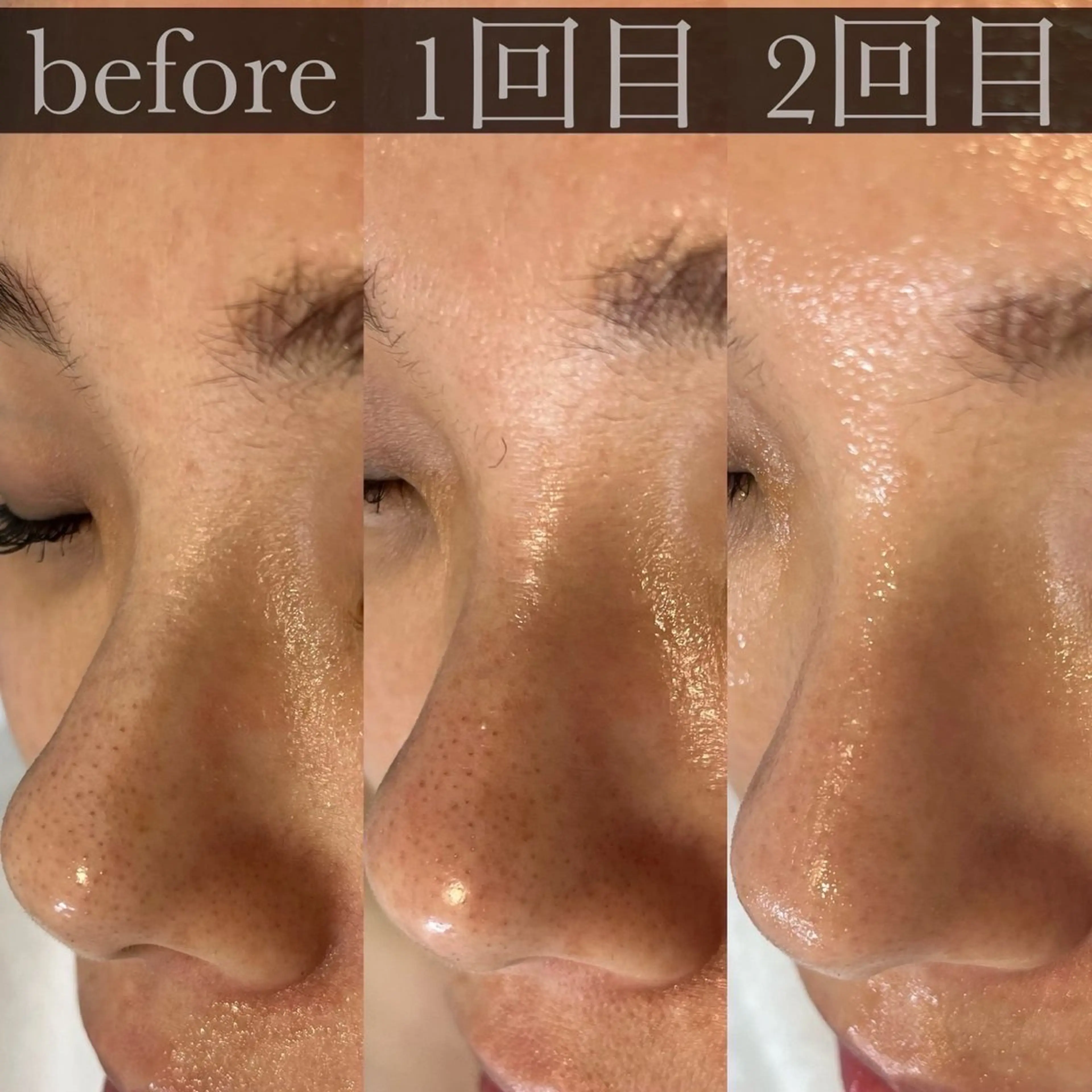 FOXYLASH inoueのエステ・リラクイメージ