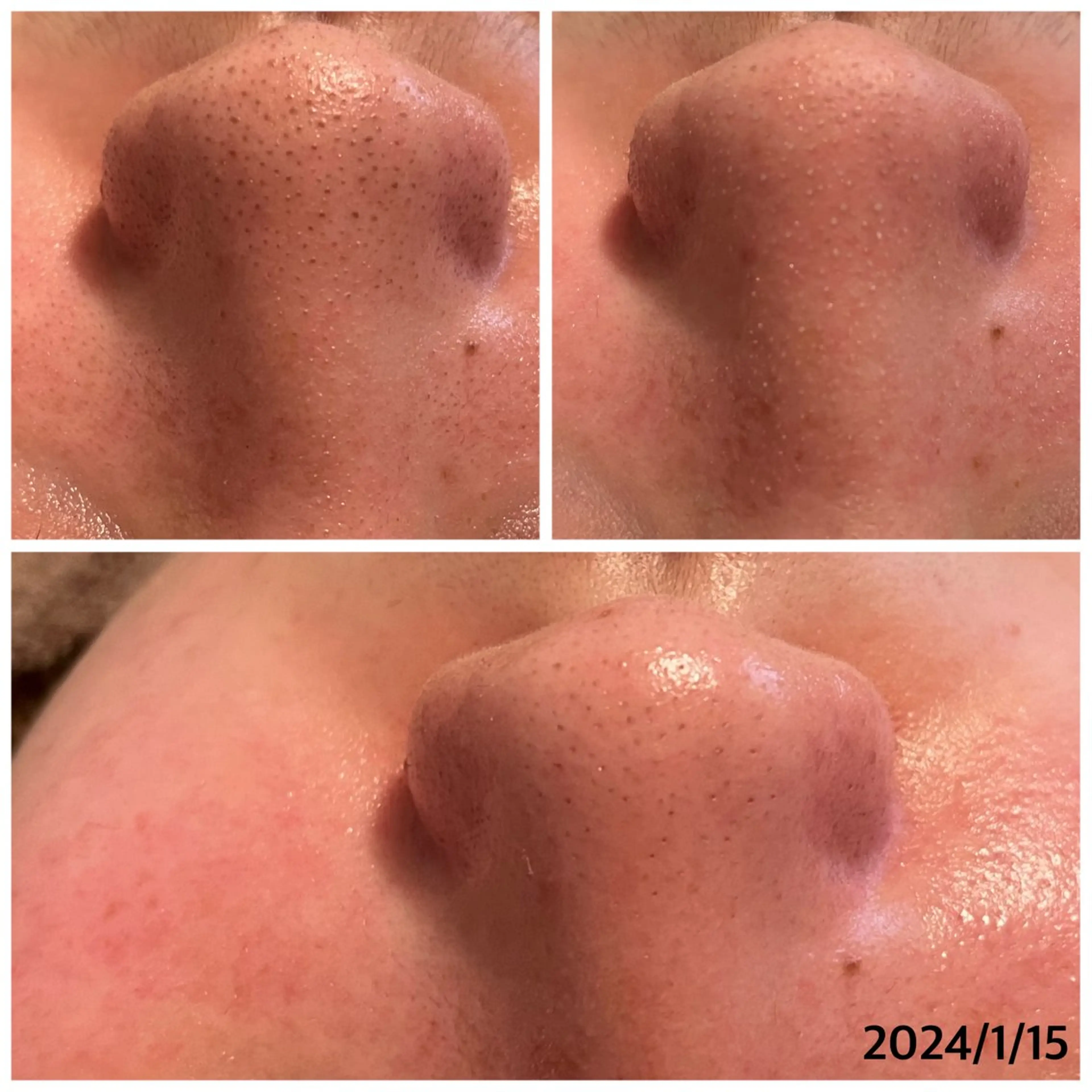 頭痛肩こり改善/小顔 サロンB&H心斎橋の眉毛・アイブロウイメージ