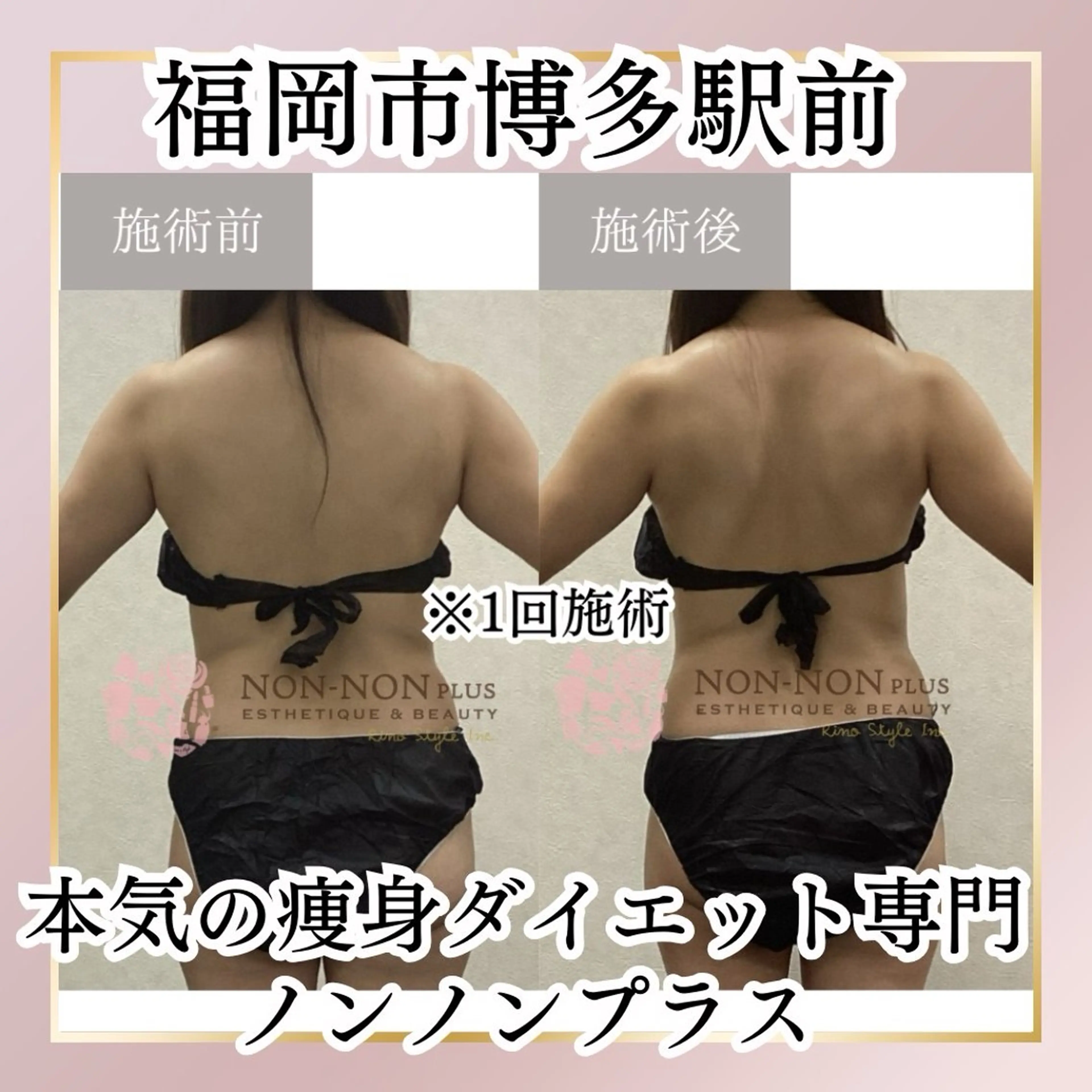 NON-NONプラス 大人の本気痩身のエステ・リラクイメージ