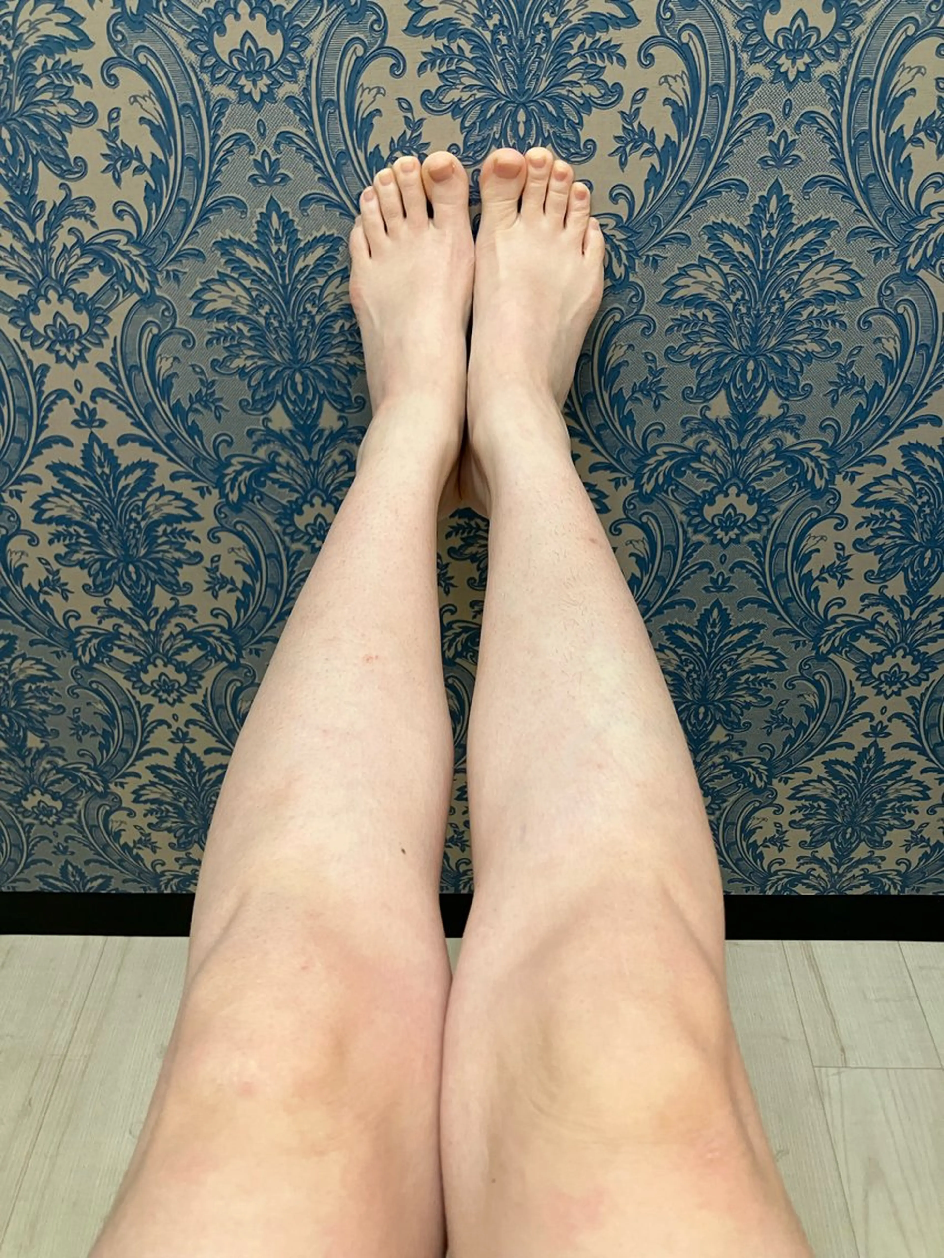 LED光脱毛🌸ひざ下1回🌸の写真