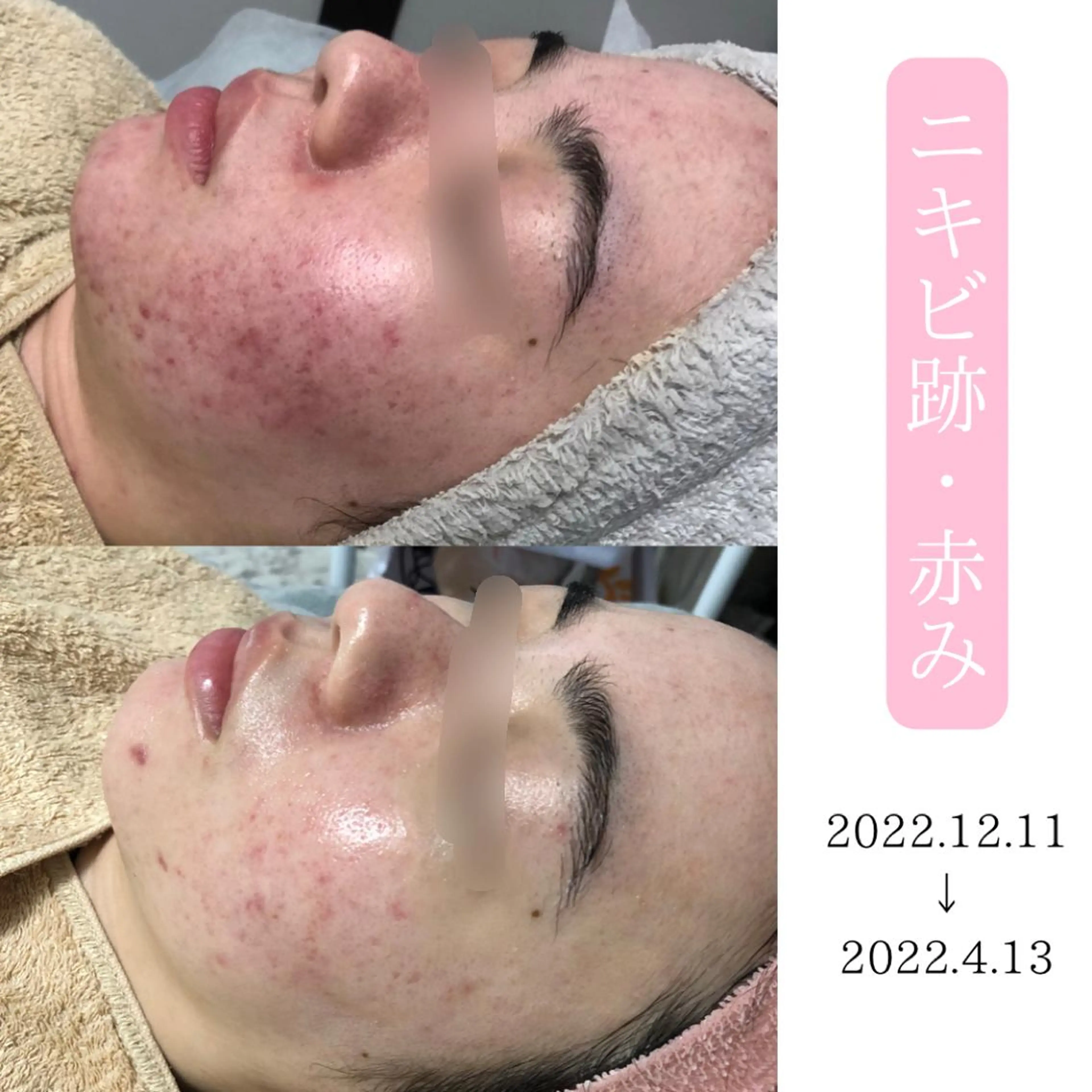 肌質改善サロン BestBelleのエステ・リラクイメージ