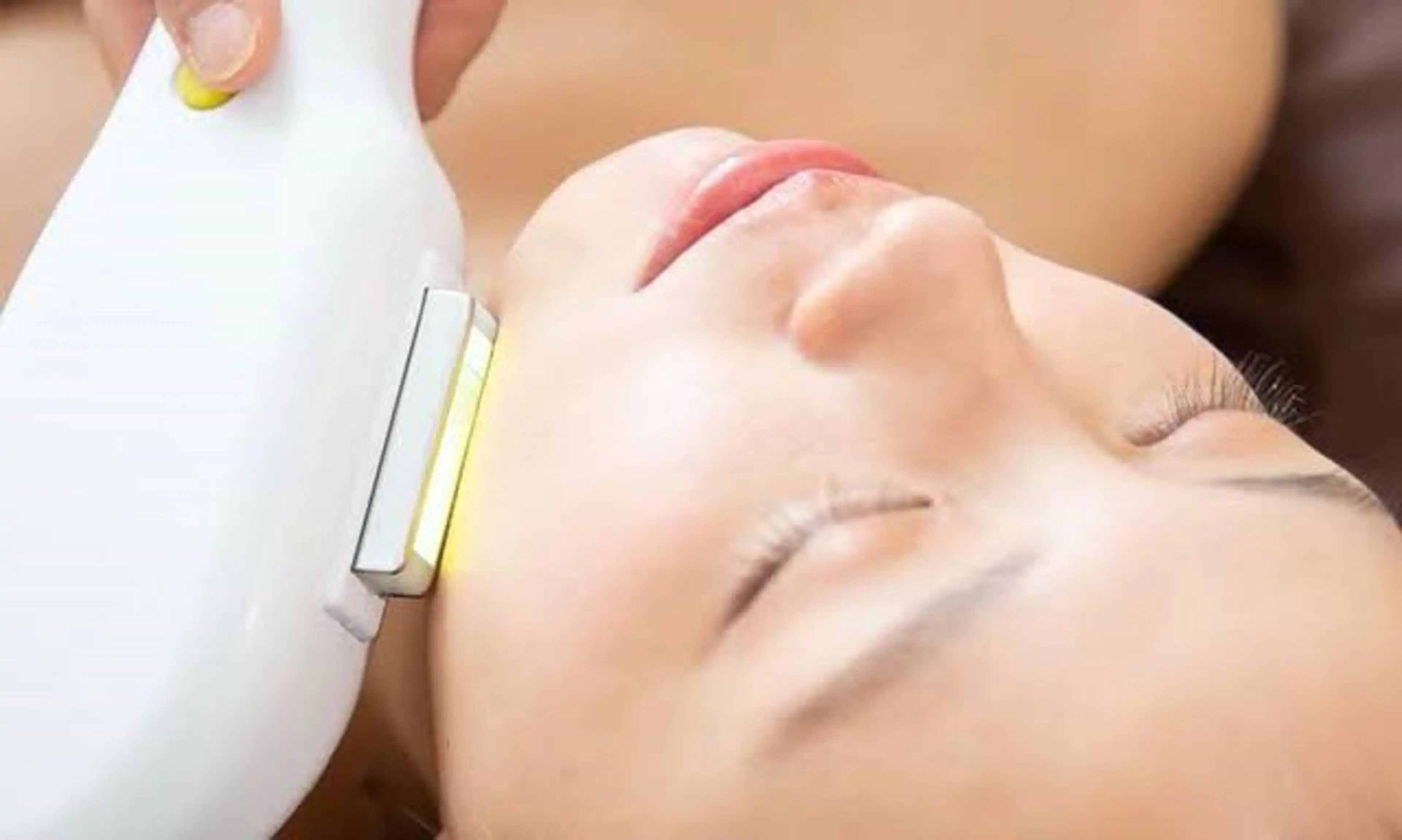 《ツヤ、引き上げ、色むら》 肌質向上✨光フェイシャルエステの写真