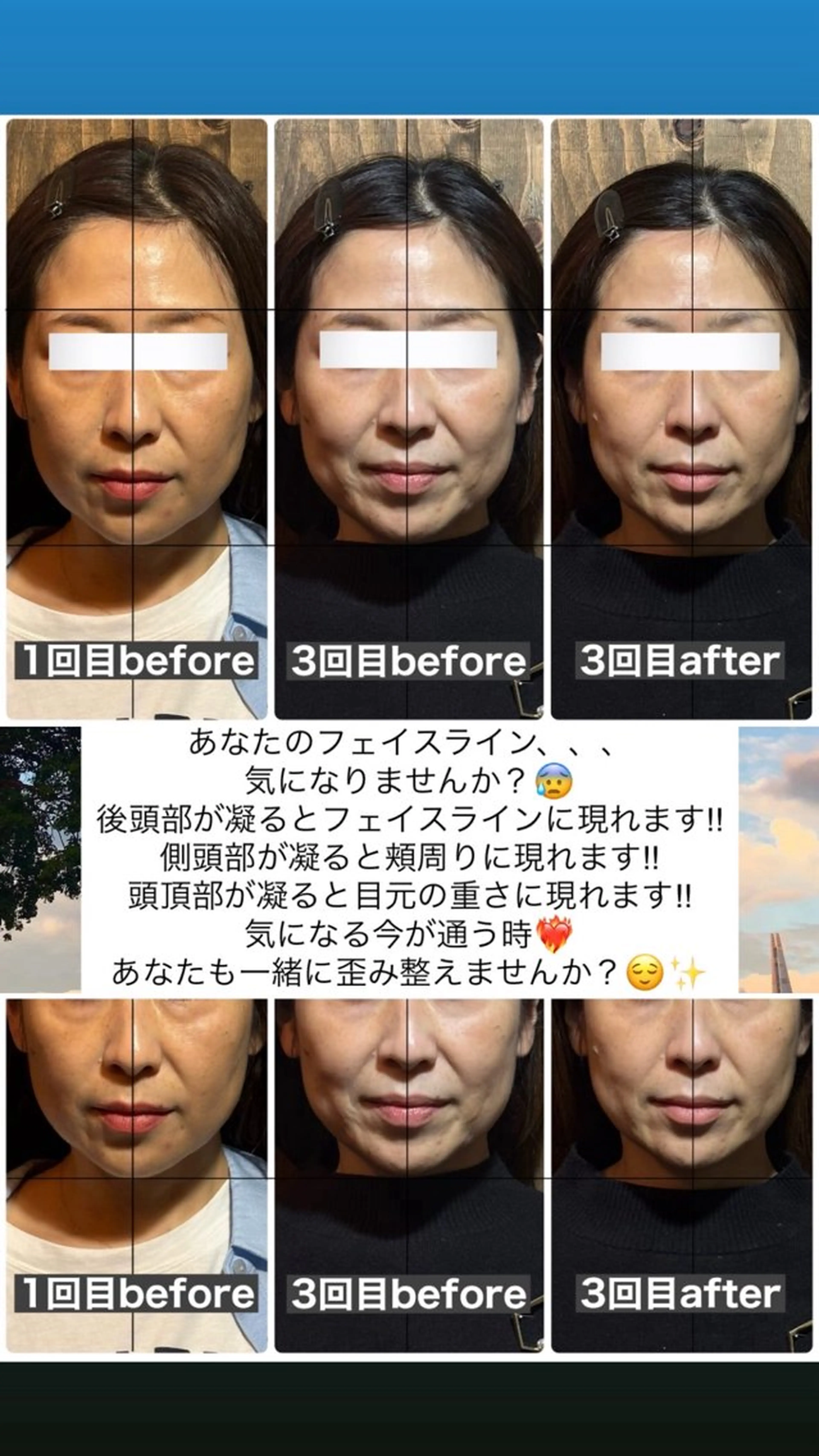 エステ リラク 💎後悔させない小顔 矯正💎イトヤマ🌱のエステ・リラクイメージ