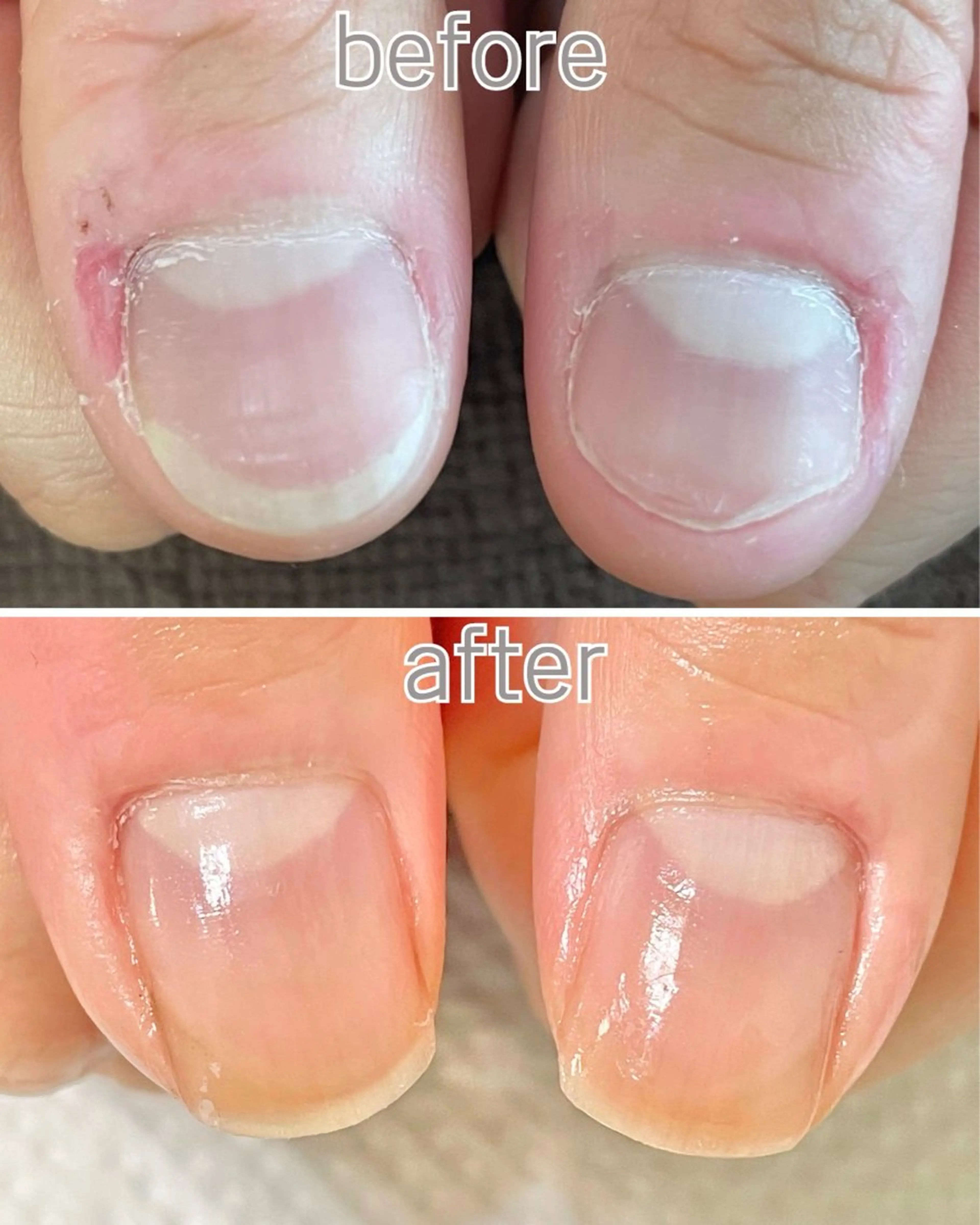 ネイル ハンドネイル ハンドケア 自爪育成専門店 Kapilinaのネイルデザイン