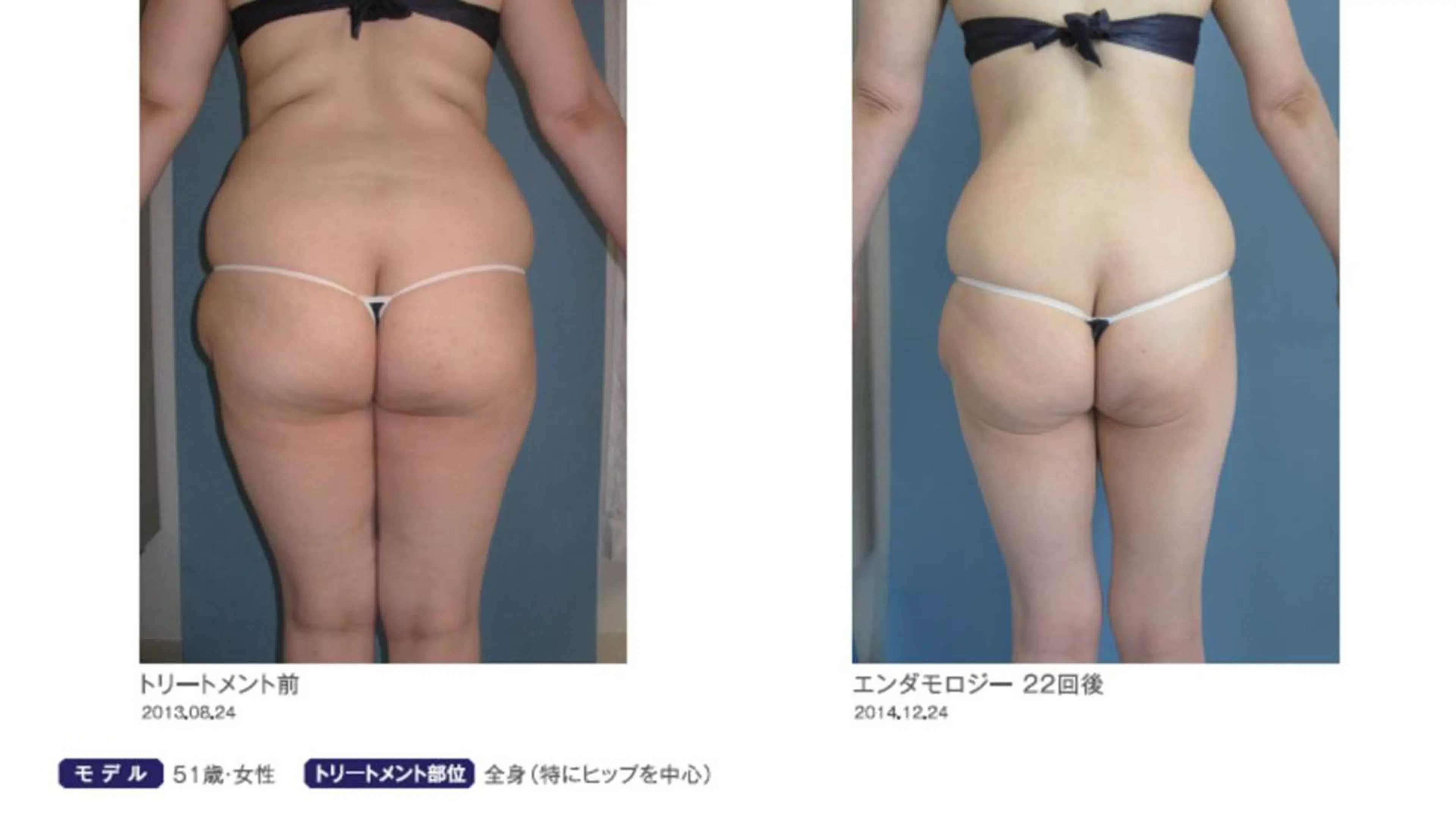 オレンジバナナ 新潟店のエステ・リラクイメージ