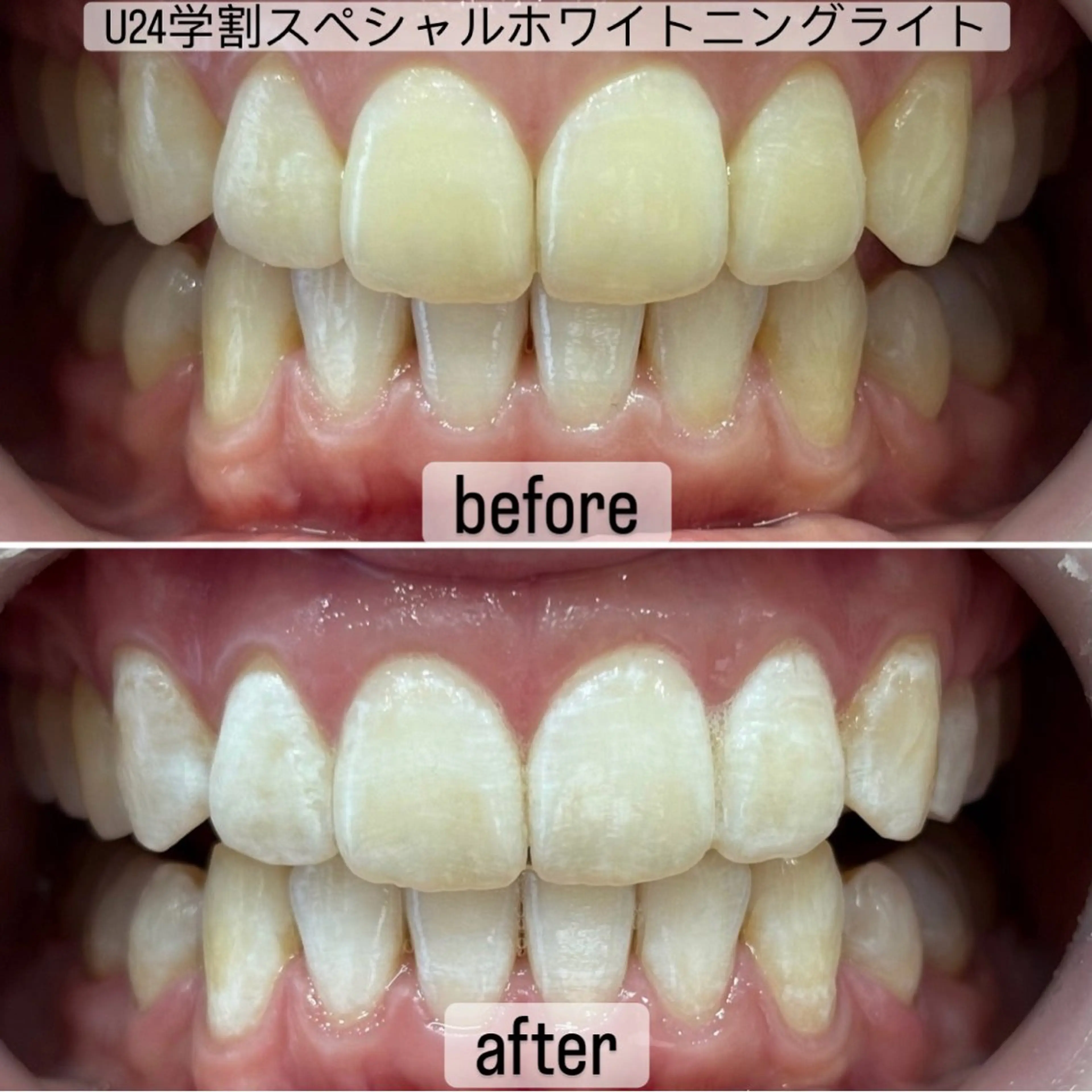 ホワイトニングサロン yatto.のその他イメージ