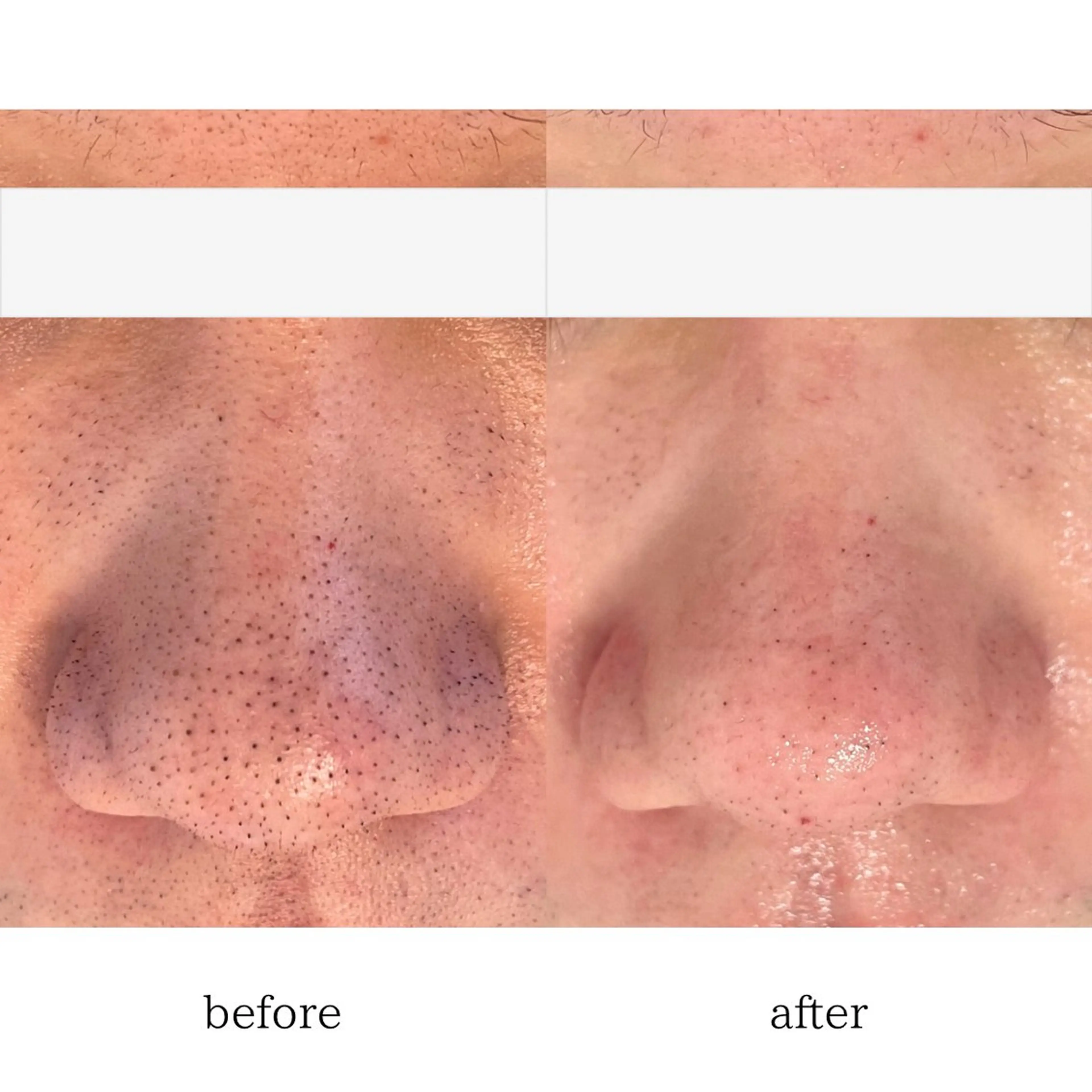 肌質改善🌿 彩也乃のエステ・リラクイメージ