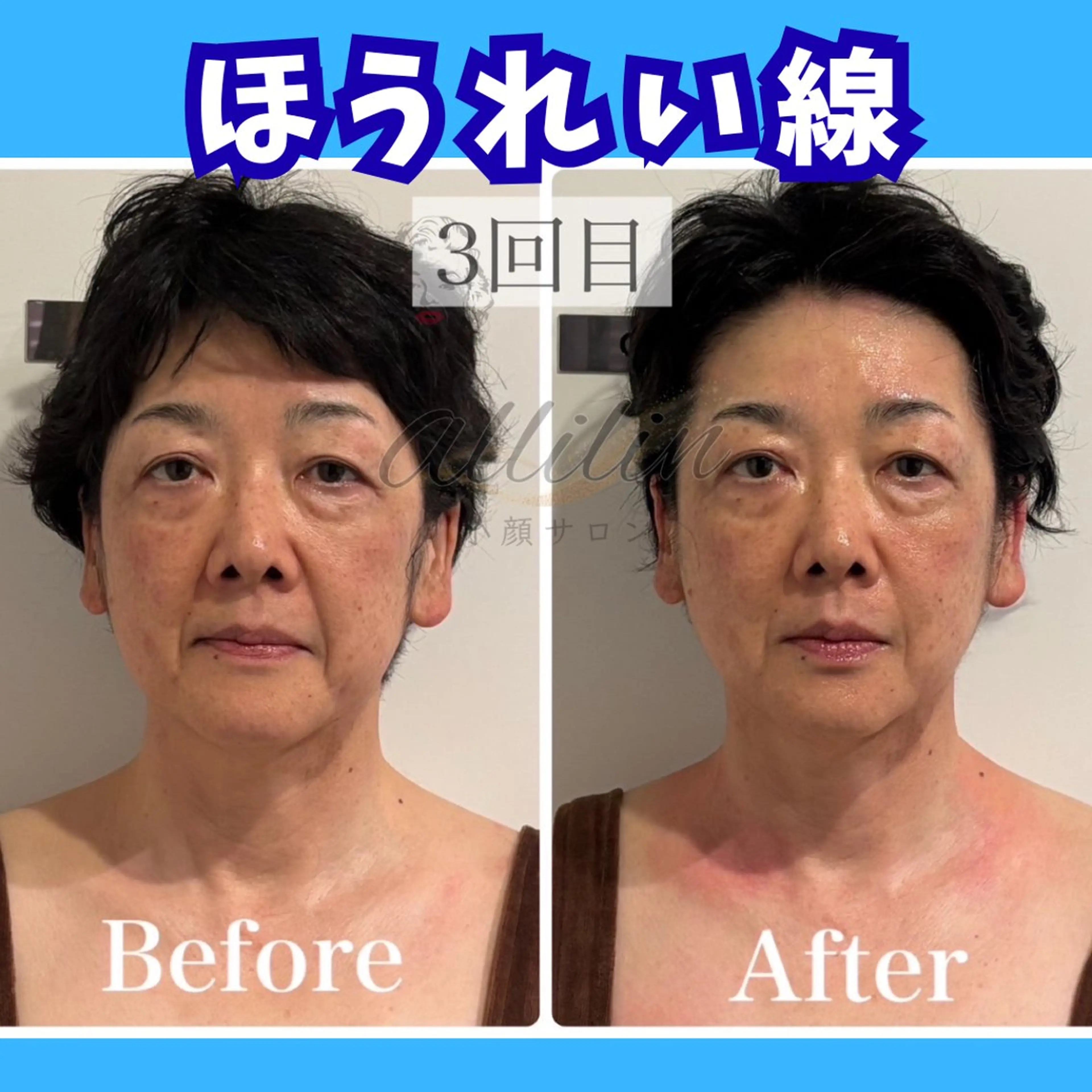 エステ 💎小顔ｻﾛﾝ アリリン銀座💎のエステ・リラクイメージ