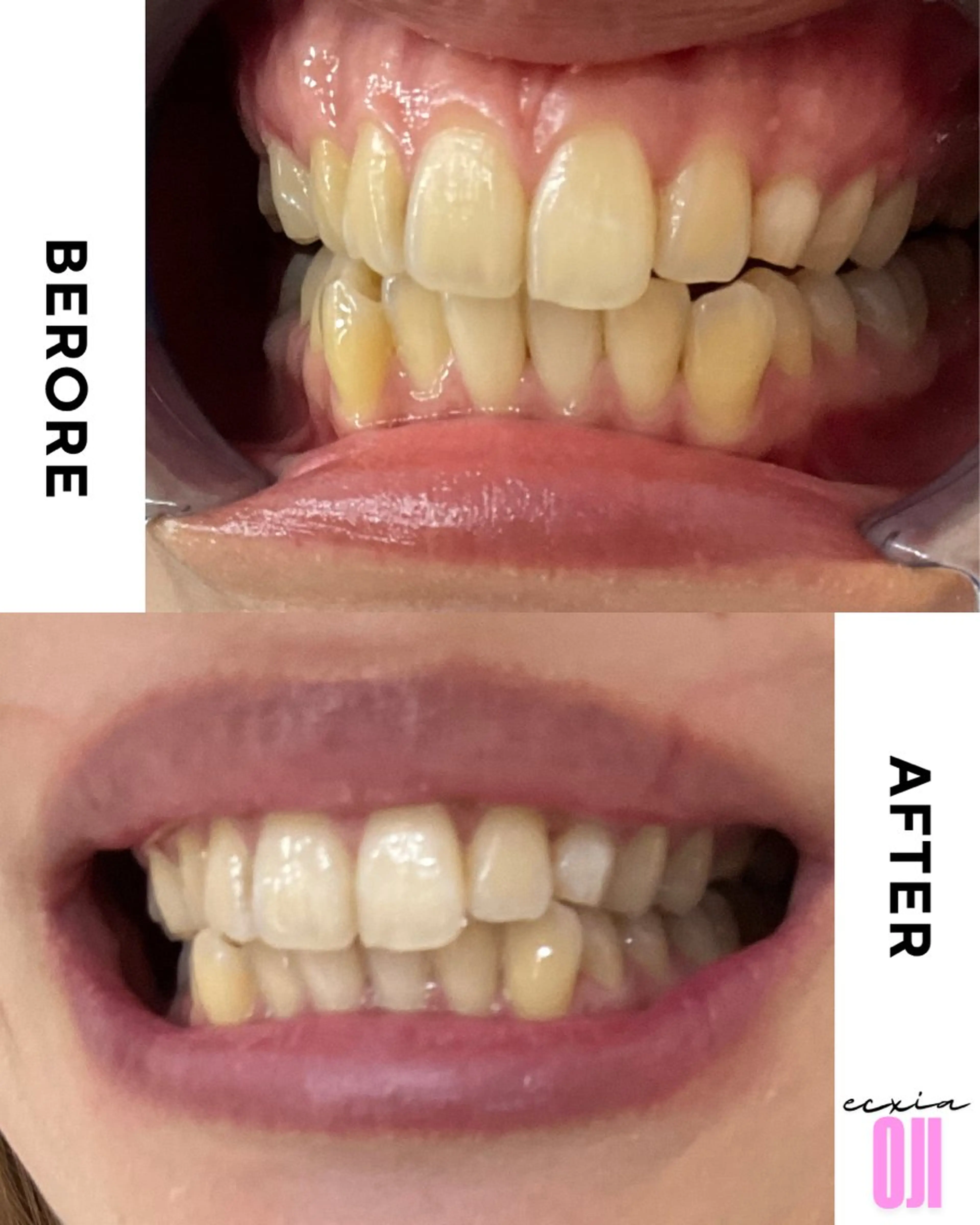 その他 セルフホワイトニングサロン エクシアホワイト 王寺店所属・エクシア王寺 NISHIKAWAのその他イメージ