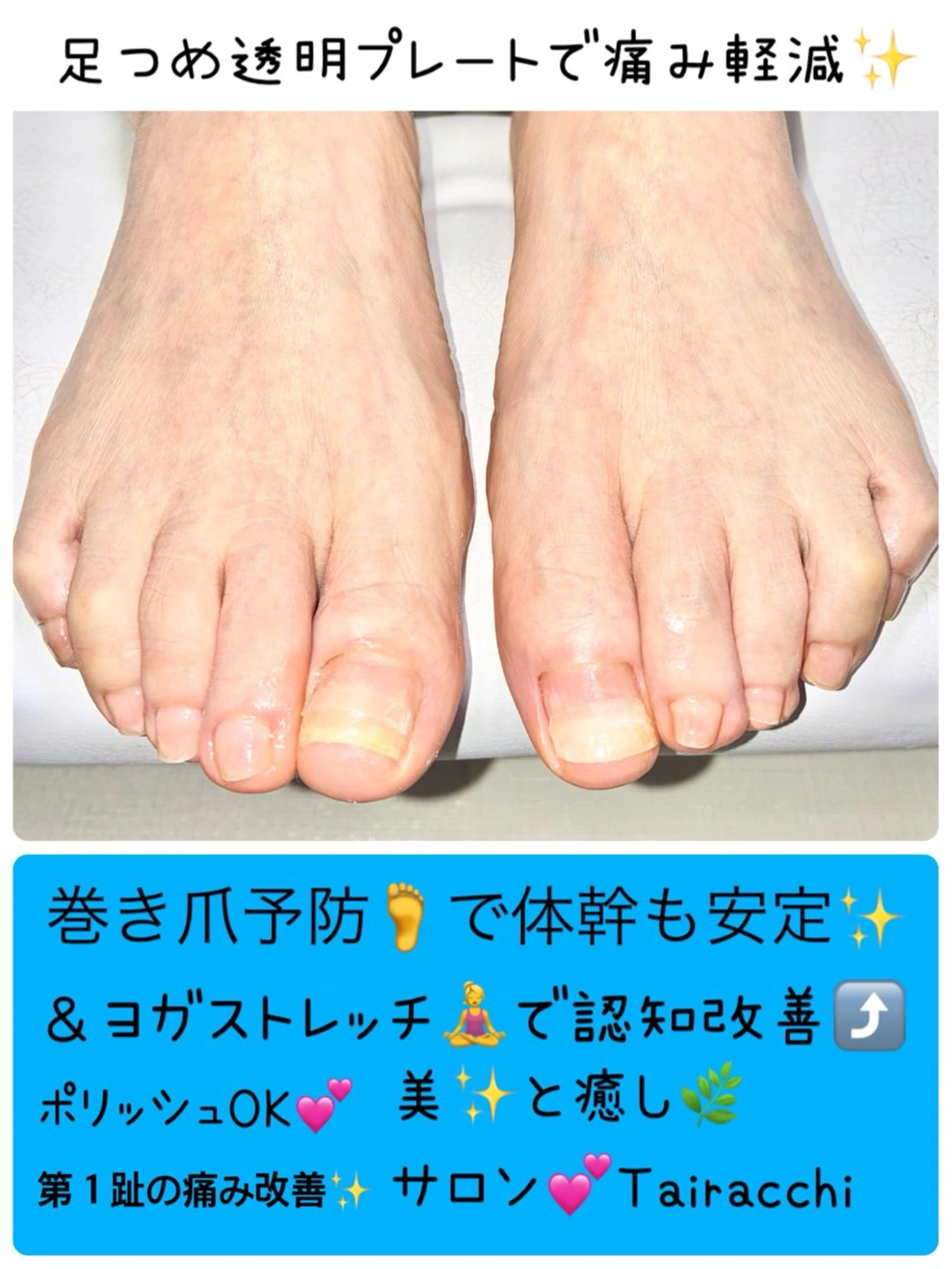 ネイル フットネイル Tairacchi タイラッチのネイルデザイン