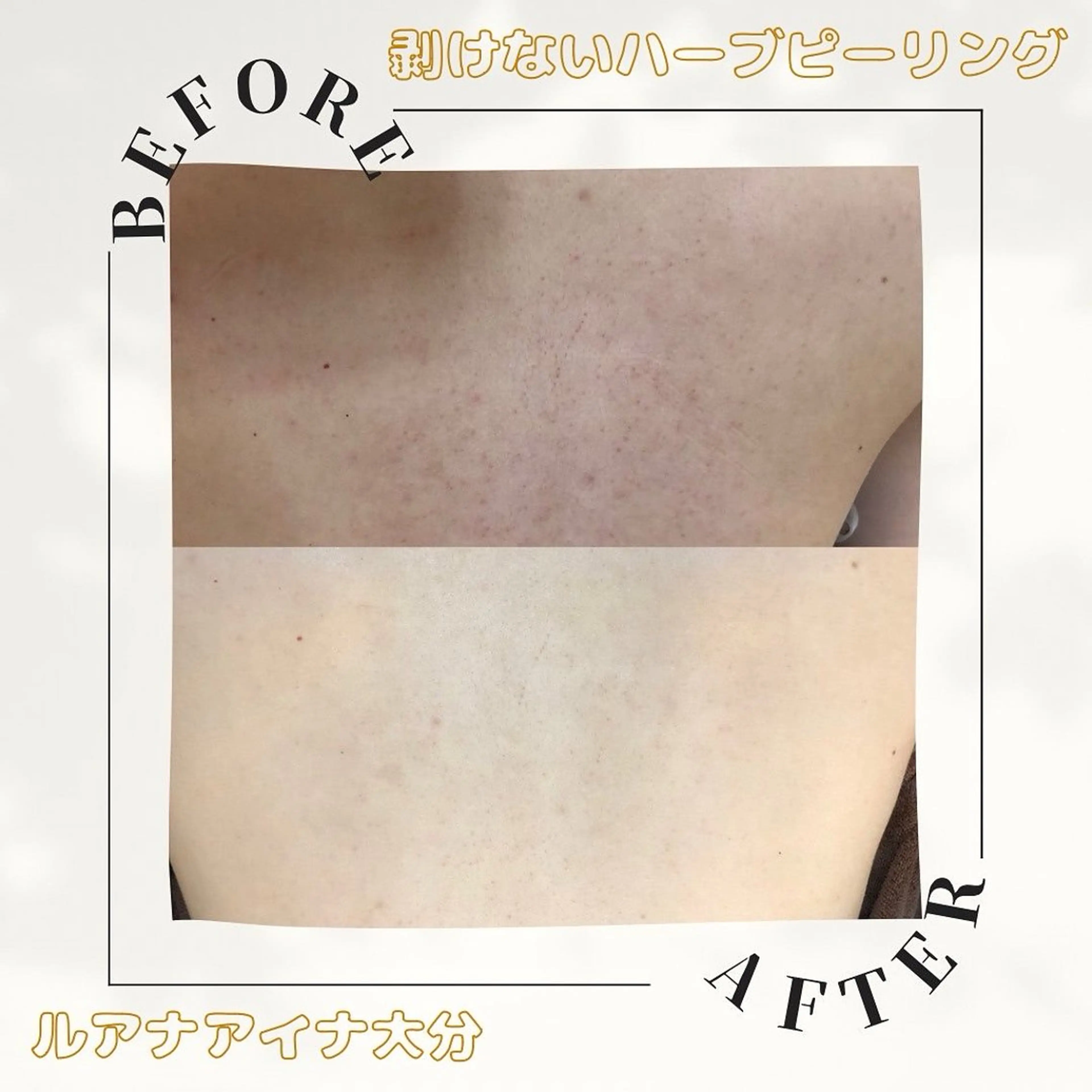 ルアナアイナ 大分のエステ・リラクイメージ