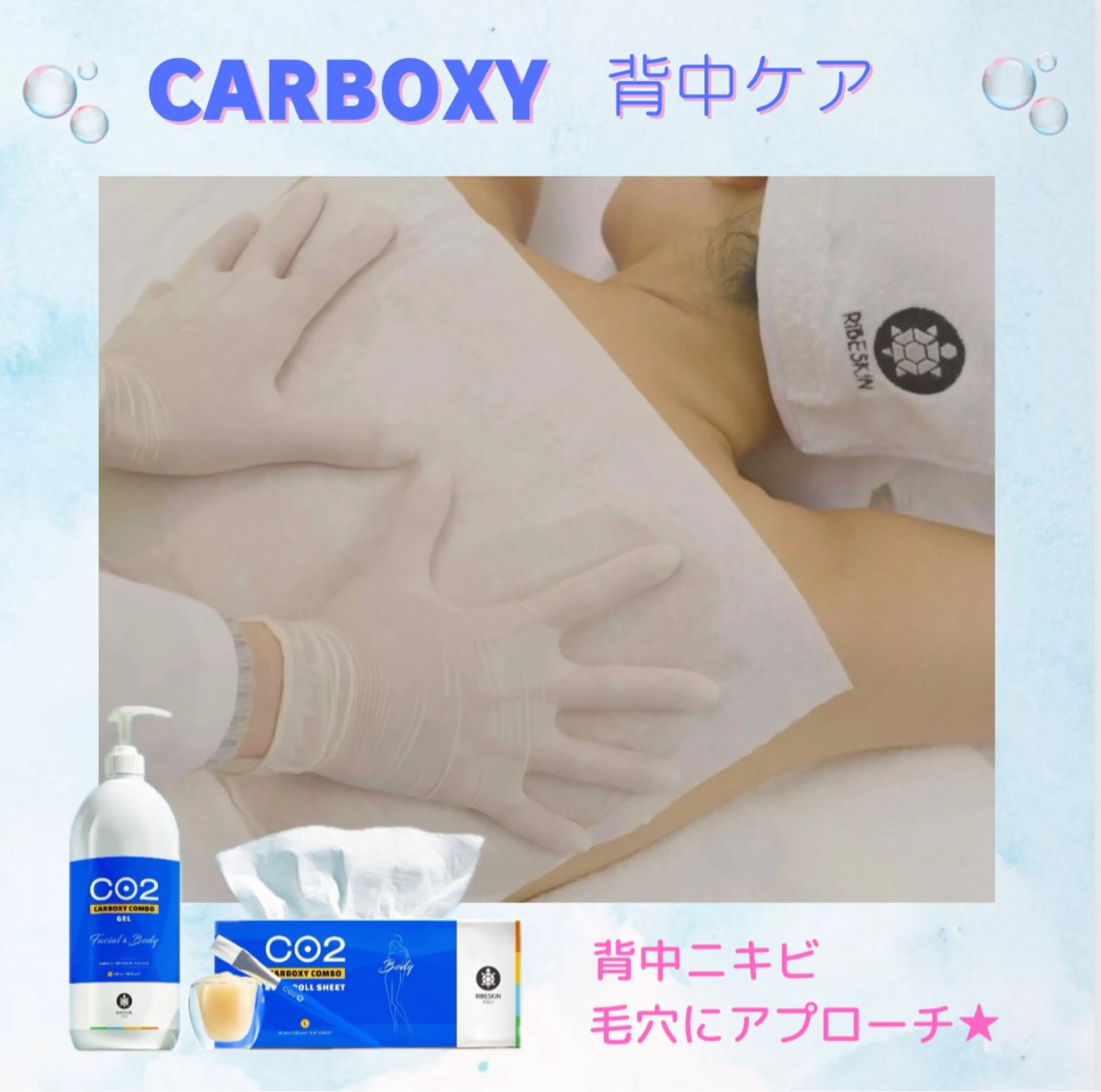 【背中ニキビ•ポツポツケア】カーボキシーボディ　背中ケアの写真