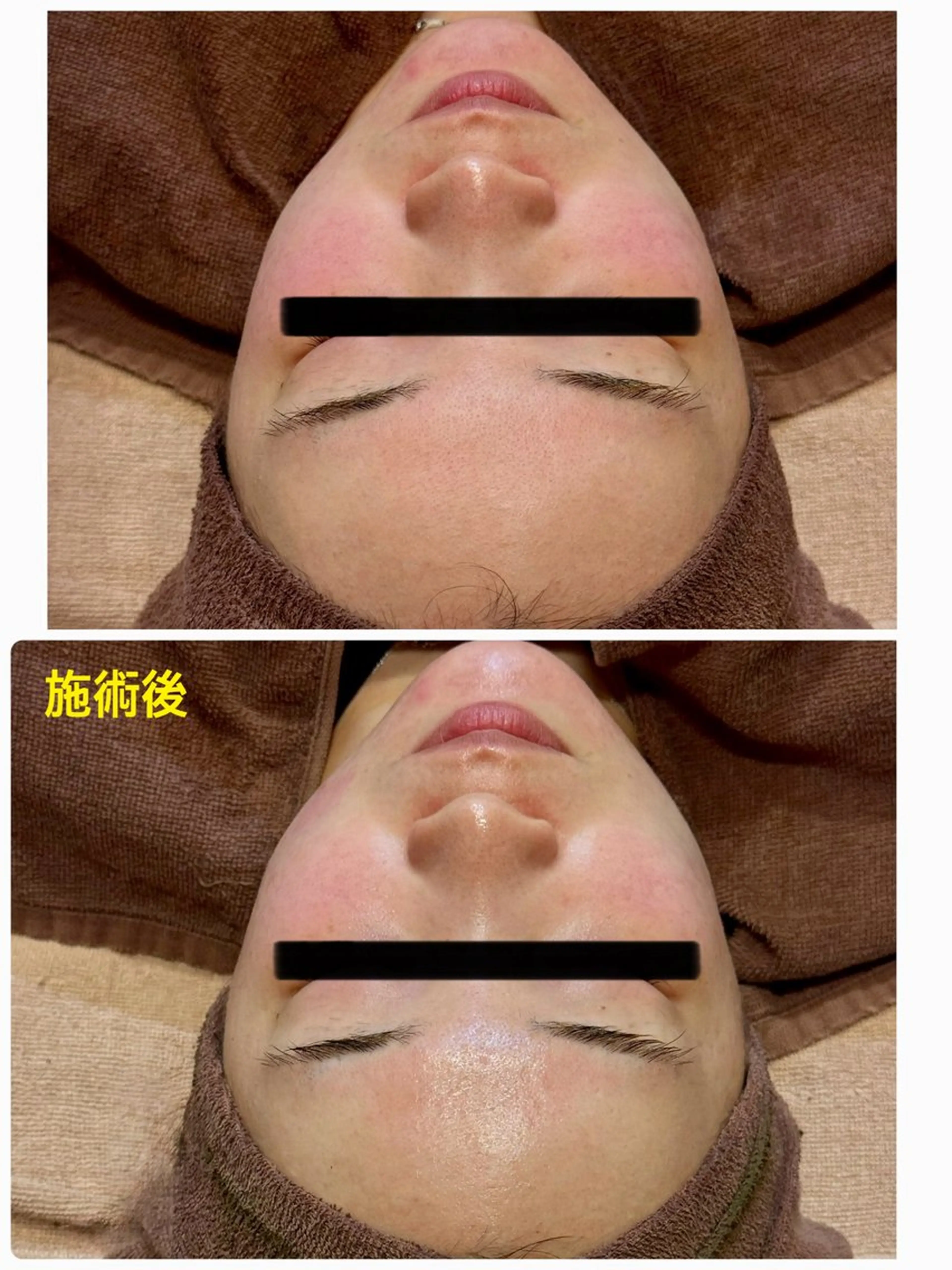 エステ ビューティーラウンジ A&A✨佐藤✨のエステ・リラクイメージ