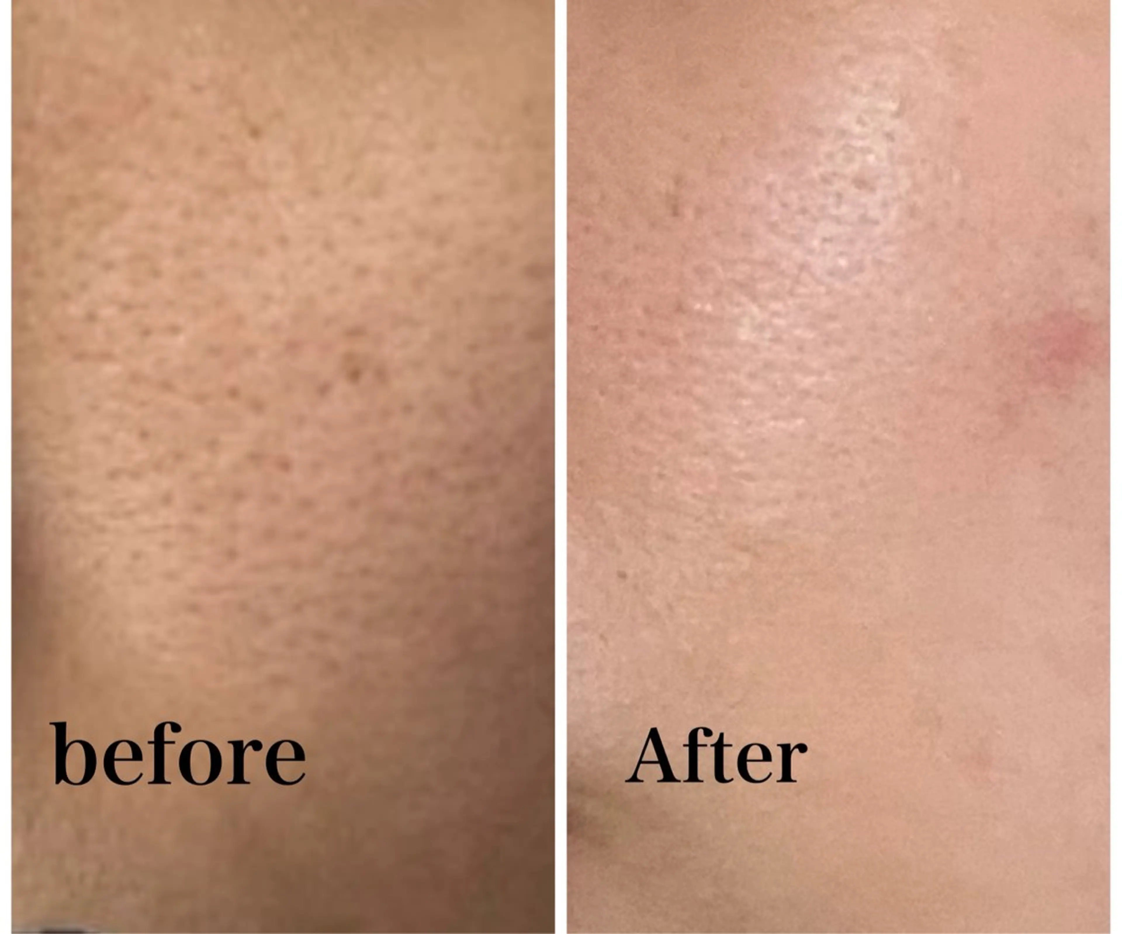 エステ ROR Akariのエステ・リラクイメージ