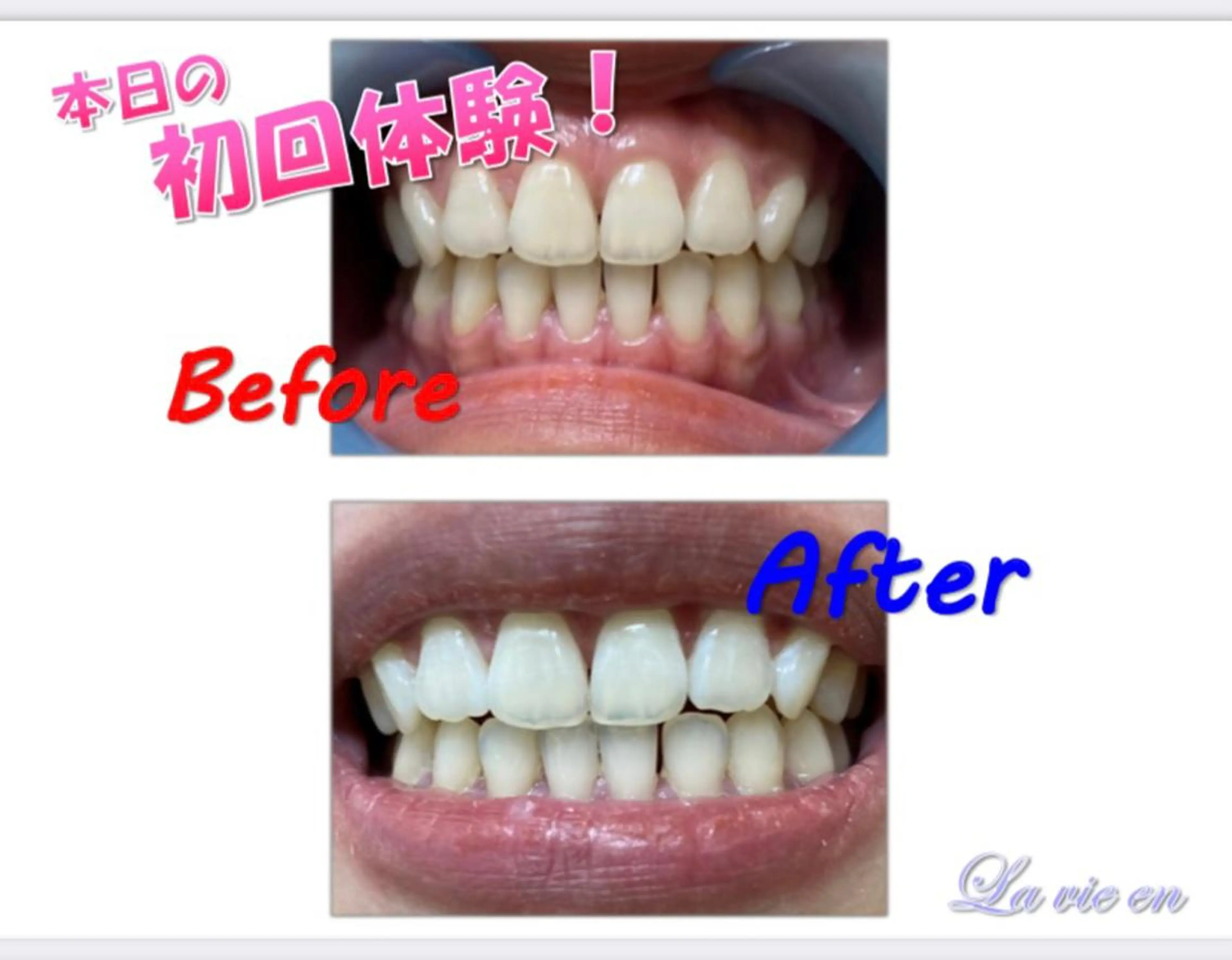 その他 ホワイトニングサロン La vie enのその他イメージ
