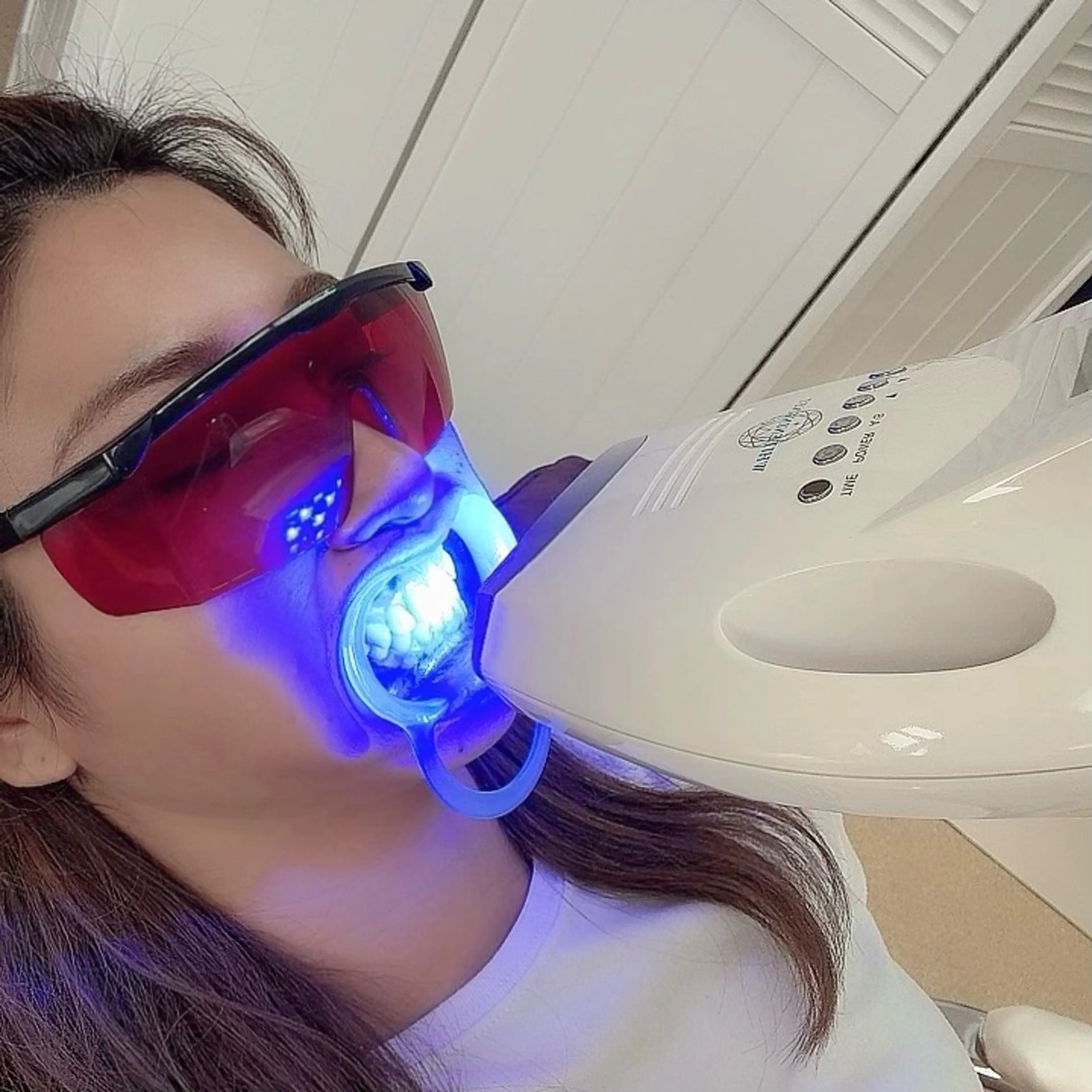 セルフホワイトニング🦷［初回限定 20分×2回コース］の写真