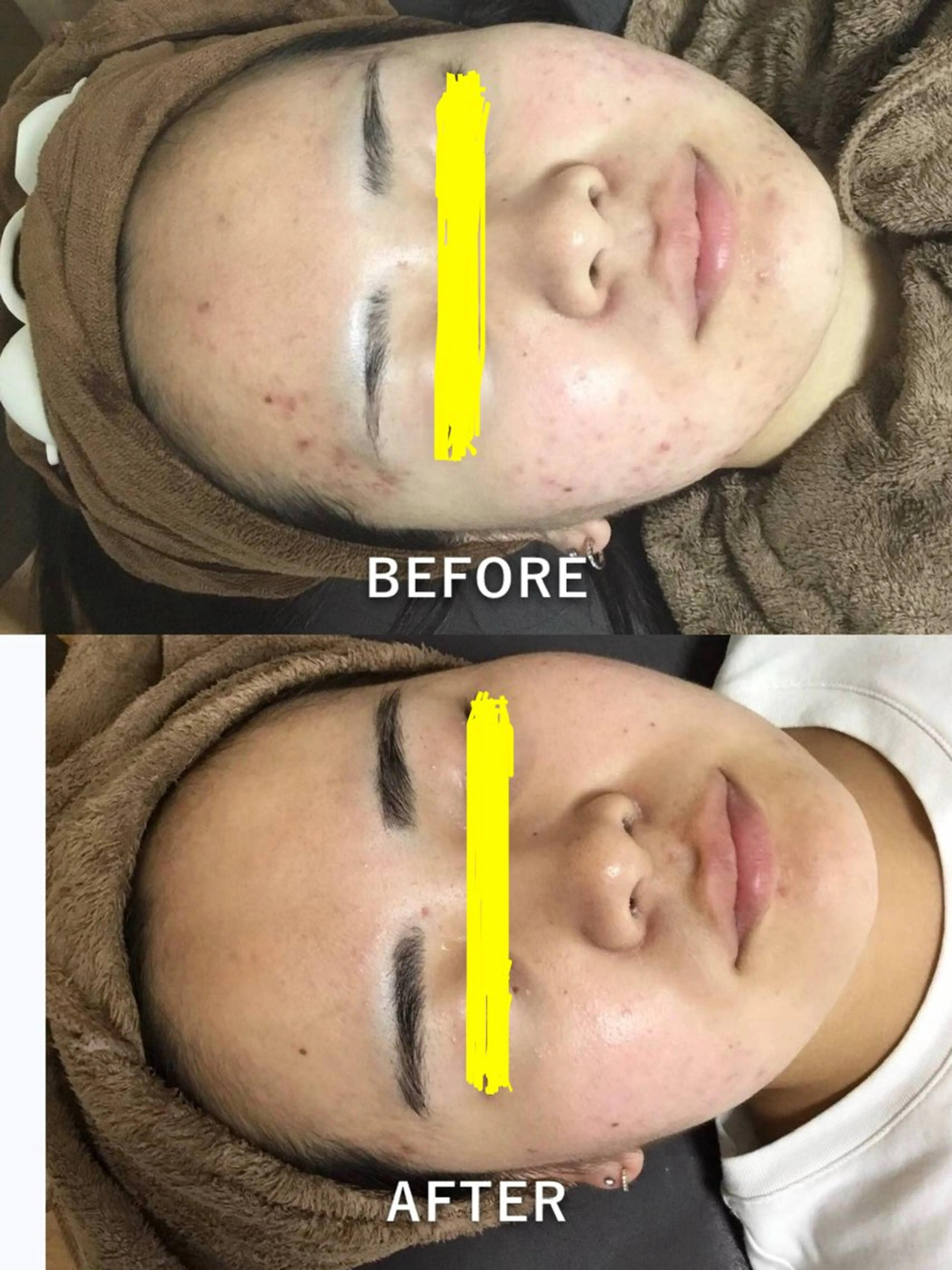 エステ 仲澤 千春のその他イメージ